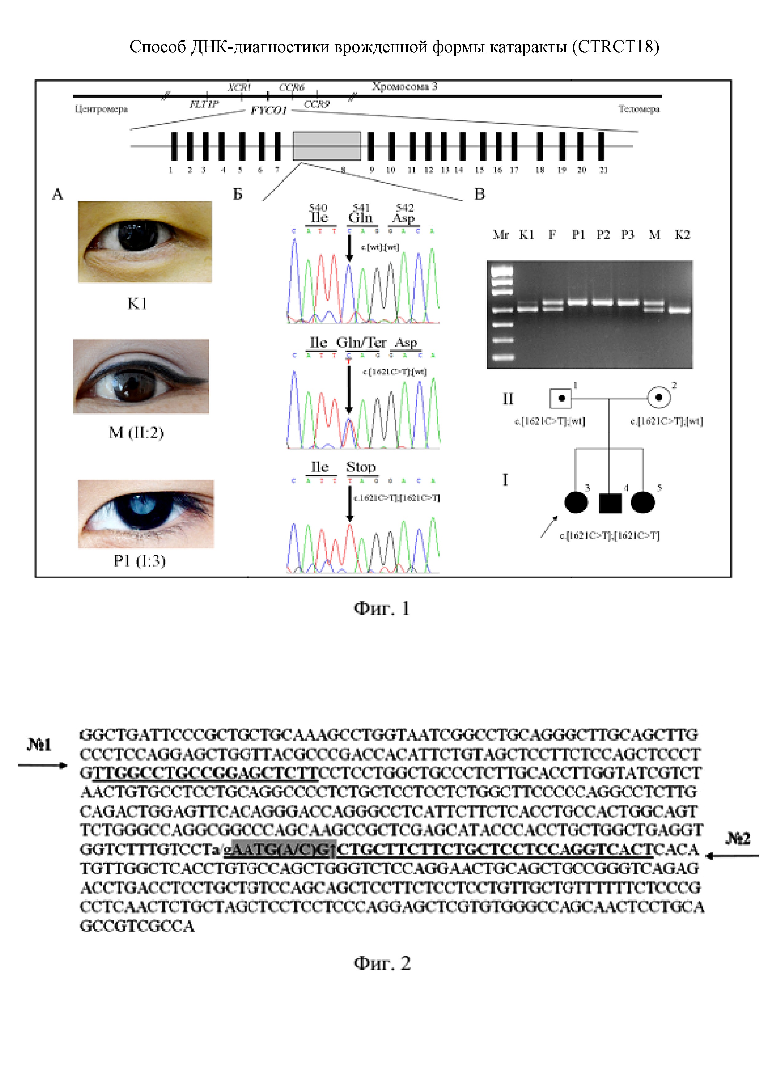 Способ ДНК-диагностики врожденной формы катаракты (CTRCT18)