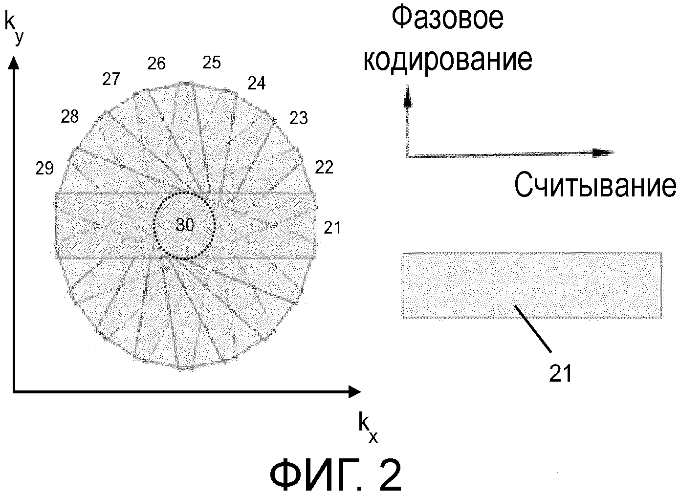 МР (МАГНИТНО-РЕЗОНАНСНАЯ) ТОМОГРАФИЯ МЕТОДОМ PROPELLER C ПОДАВЛЕНИЕМ АРТЕФАКТОВ