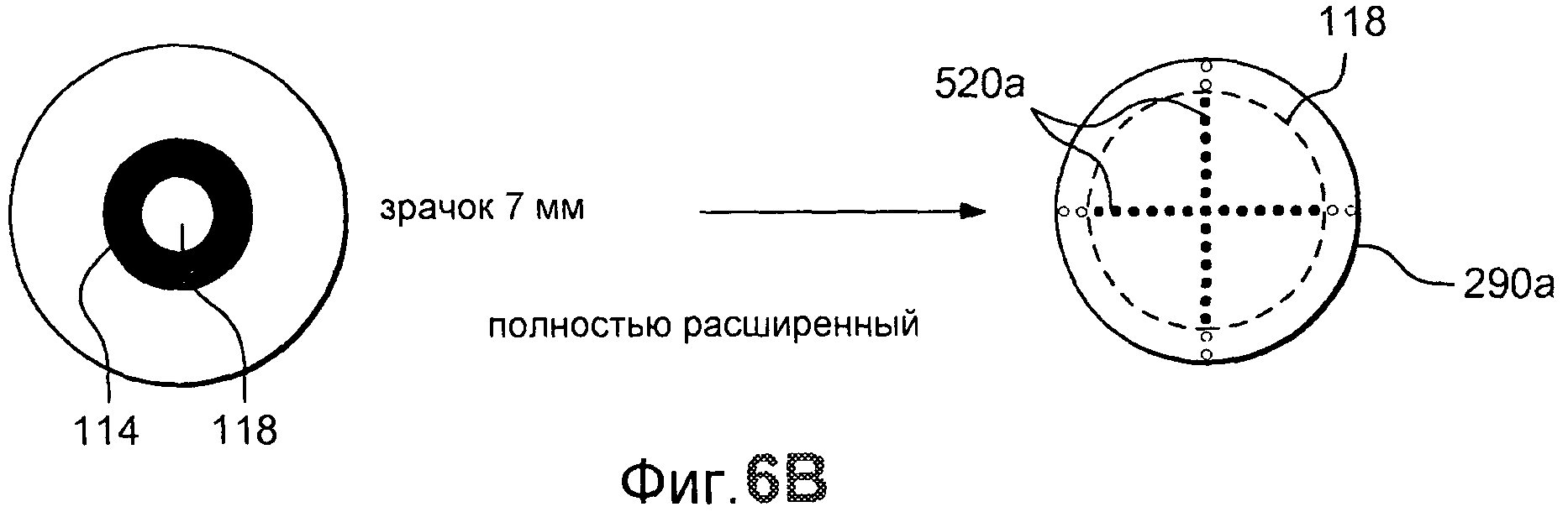 Константа иол. Линзовый растр. Изображение линзового растра. Изображение линзового растра пластик. ИОЛ код 1223.