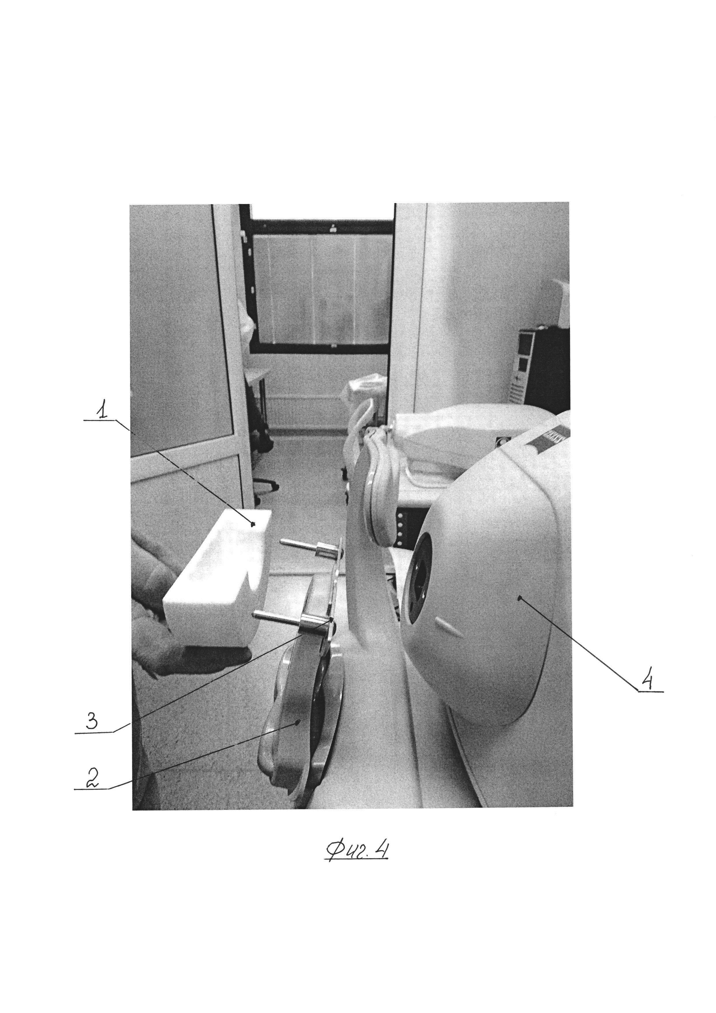 Способ измерения толщины донорской роговицы в ходе операции задней автоматизированной послойной кератопластики и устройство для его осуществления