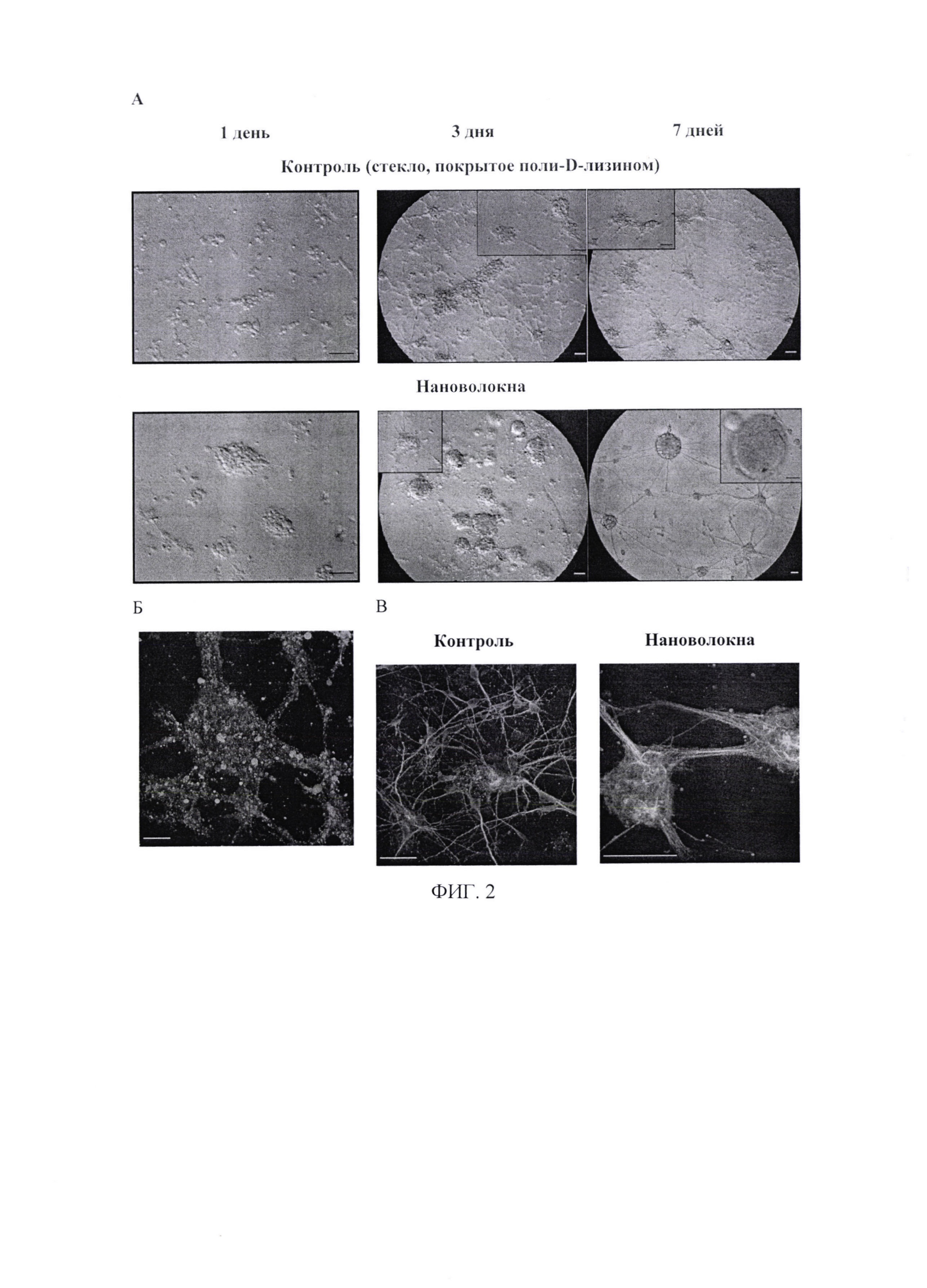 Способ получения органоидов мозга (нейросфер) на скаффолдах из высокоориентированных нановолокон