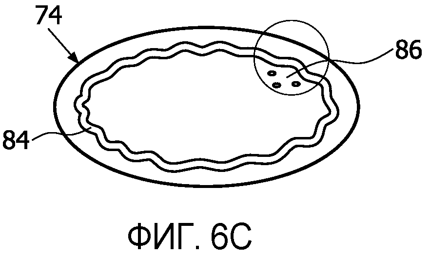 ПЕРИСТАЛЬТИЧЕСКАЯ СОСКА