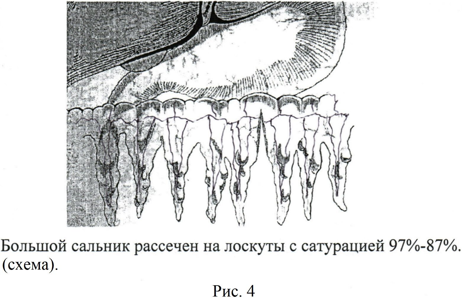 Большой сальник схема