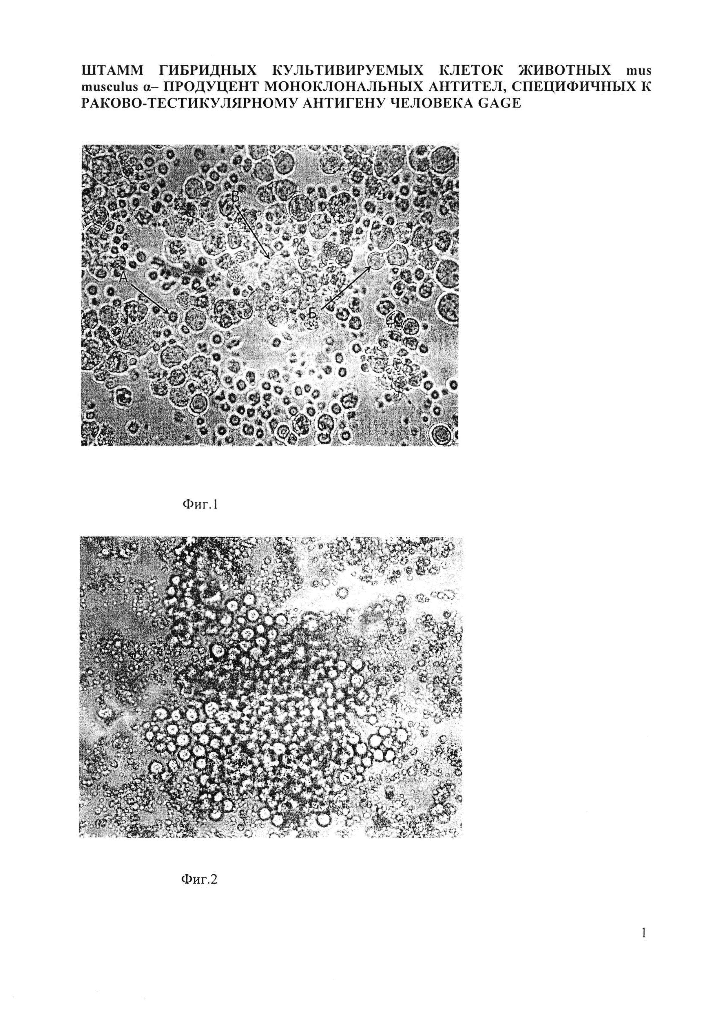 Штамм гибридных культивируемых клеток животных mus musculus α - продуцент моноклональных антител, специфичных к раково-тестикулярному антигену человека GAGE