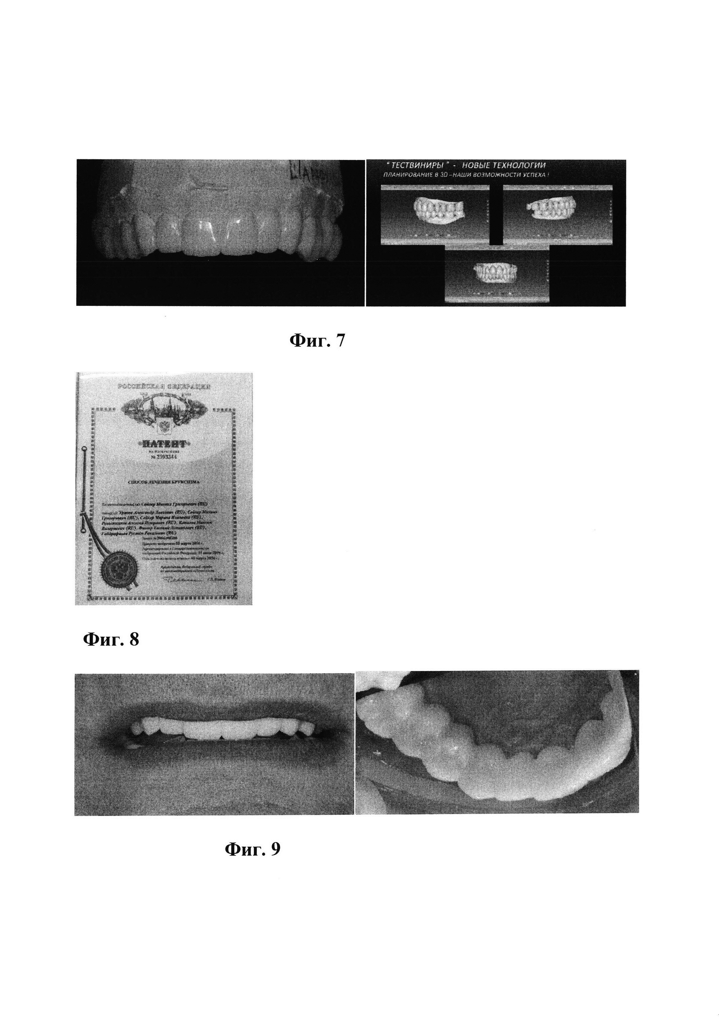 Способ диагностики и восстановления функции до физиологической нормы или максимально приближенной к ней формы компенсации работы стоматологического комплекса