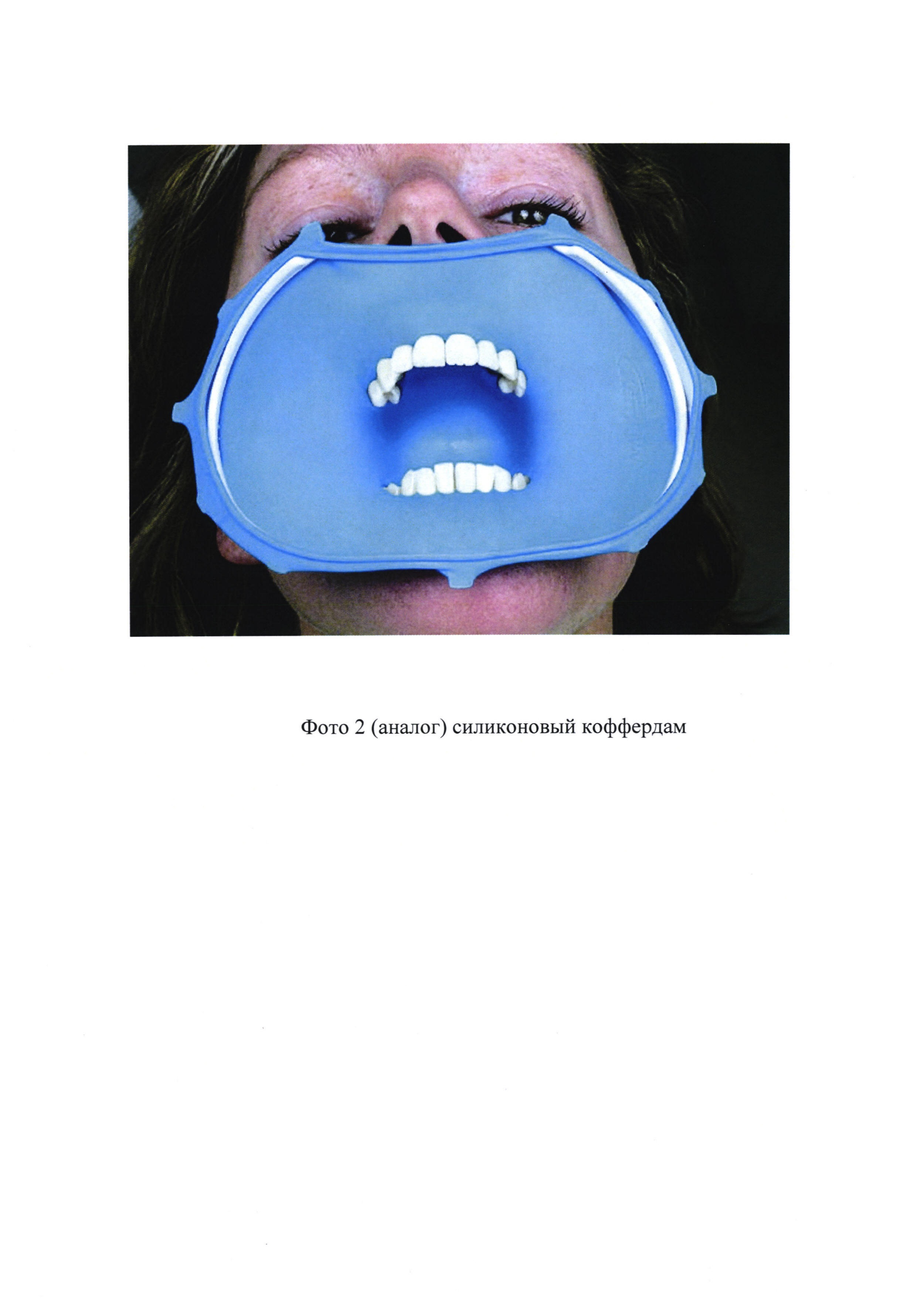 Стоппер для защиты органов полости рта от распространения коротковолнового ультрафиолетового излучения