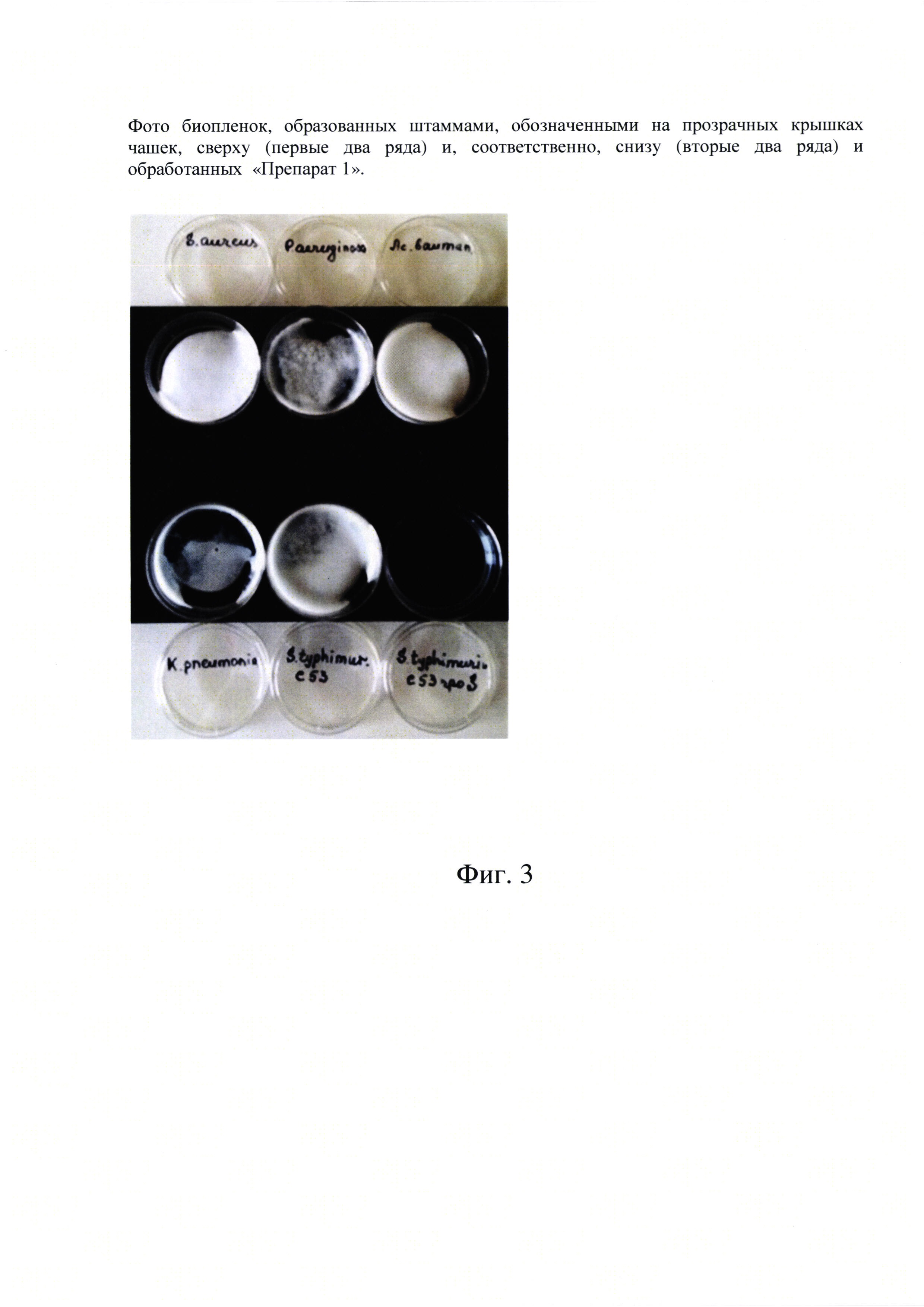 Экспресс-тест для обнаружения биологических плёнок бактерий на абиотических поверхностях (варианты)
