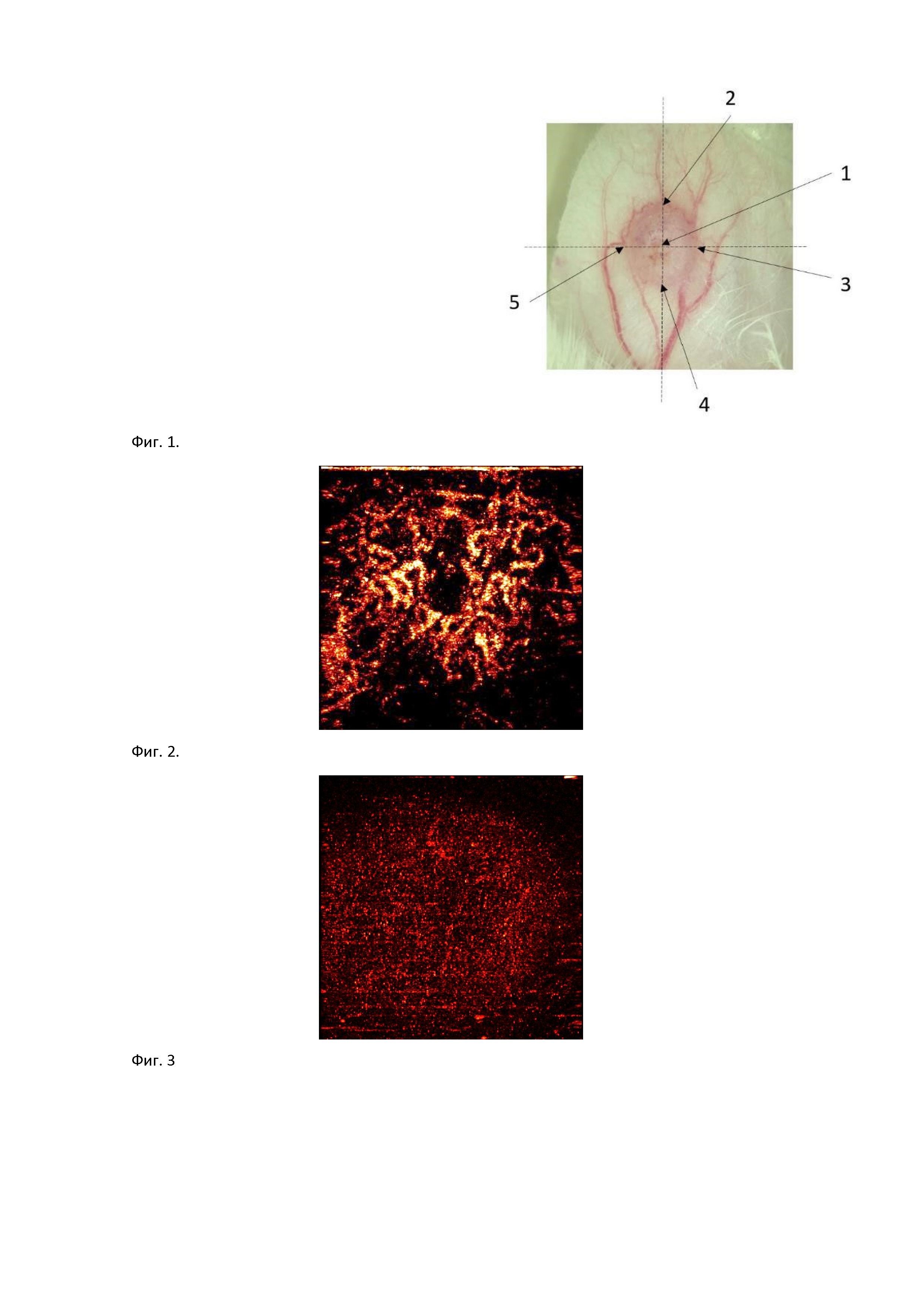 Способ оценки эффективности фотодинамической терапии методом оптической когерентной ангиографии в эксперименте
