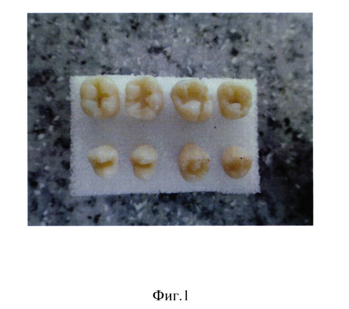 Способ контроля технологии моделирования микрорельефа окклюзионной поверхности зуба