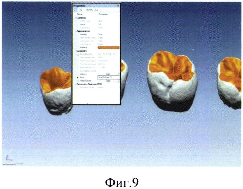 Способ контроля технологии моделирования микрорельефа окклюзионной поверхности зуба