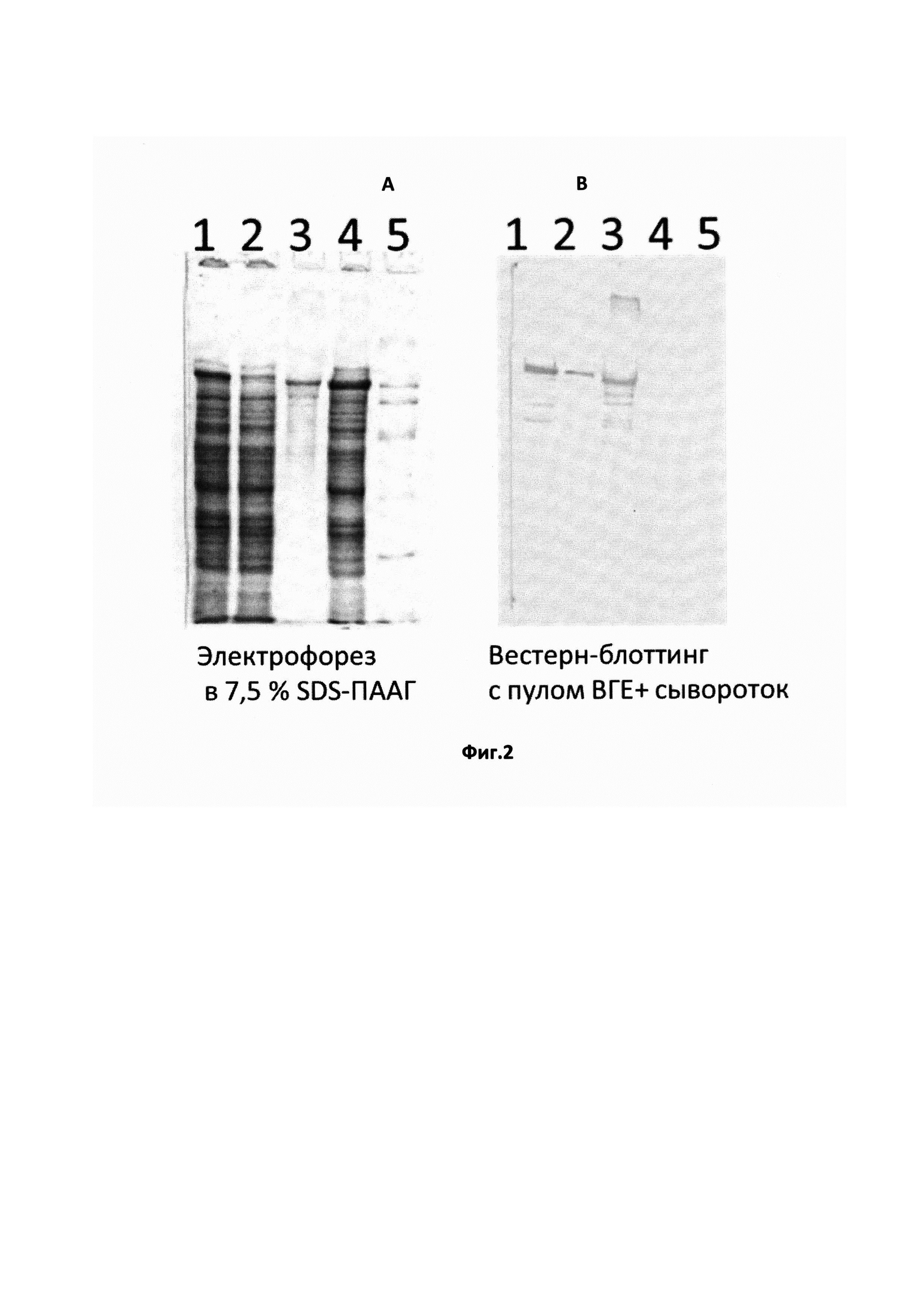 Рекомбинантный белок, содержащий антигенно-значимые фрагменты белков вируса гепатита Е, используемый в тест-системах для серодиагностики гепатита Е (варианты)