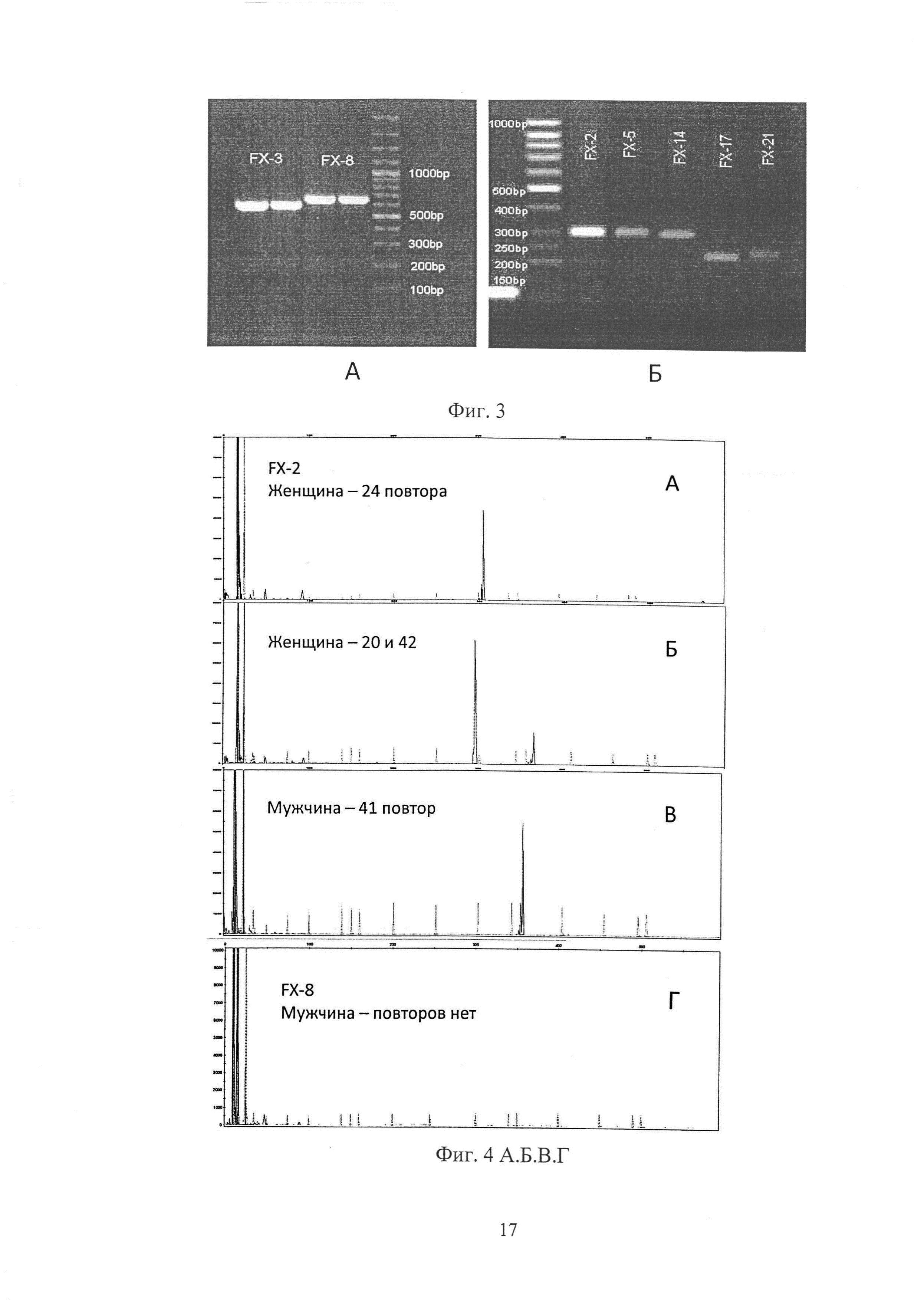 Способ выявления экспансии тринуклеотидных CGG-повторов в 5'-нетранслируемой, промоторной области гена FMR1 при заболевании синдрома атаксии/тремора, ассоциированного с ломкой Х-хромосомы (FXTAS)