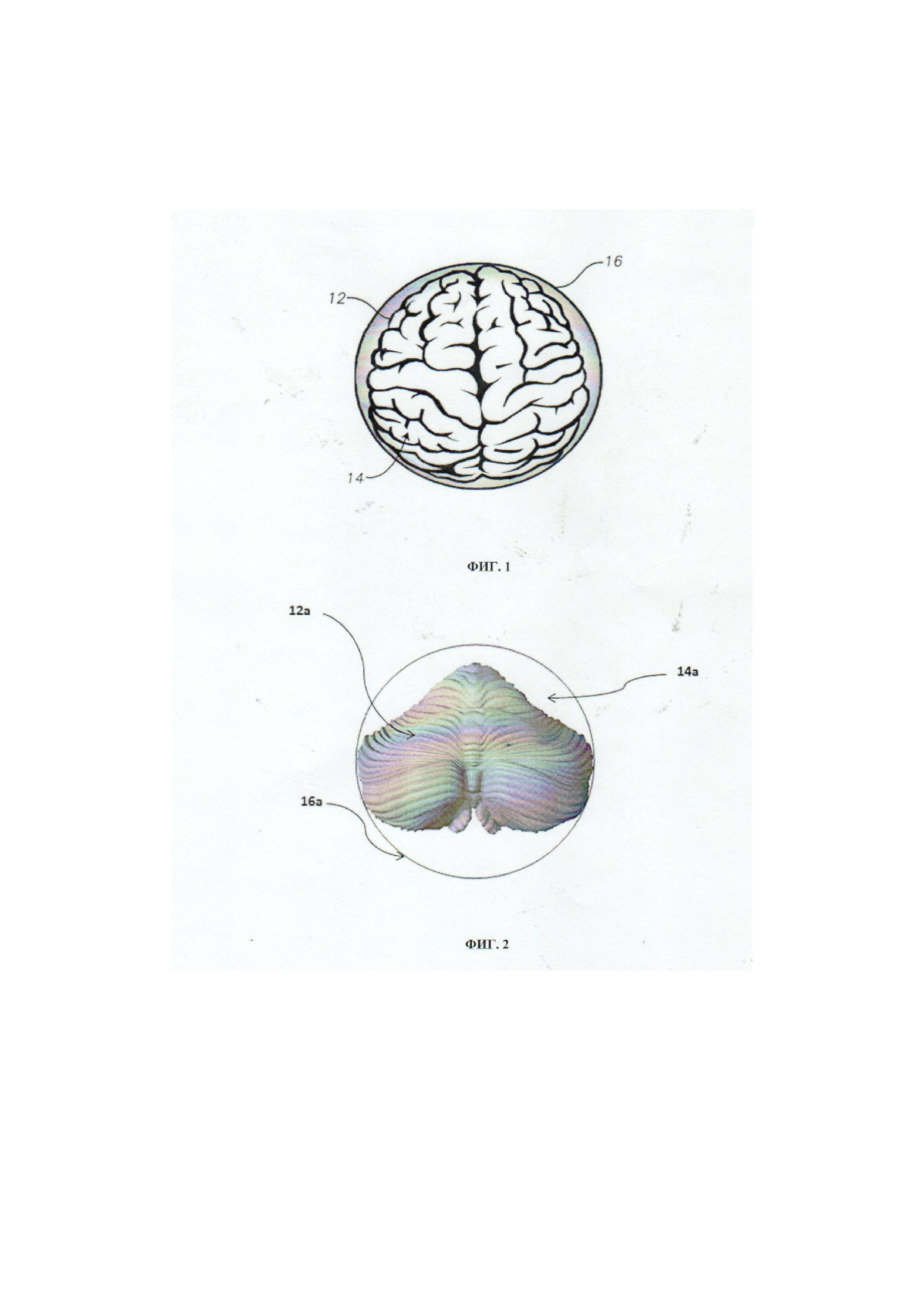 Способ макроэнцефалометрии полушарий большого мозга и мозжечка с учетом их аккомодации в закрытом окружающем человека пространстве