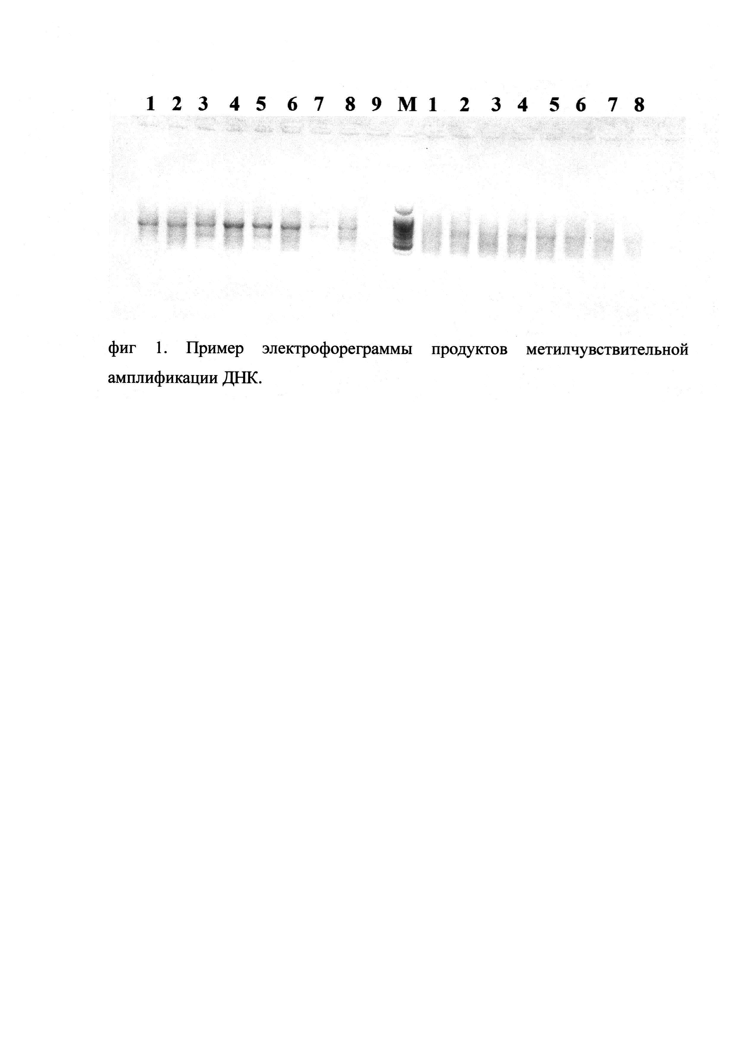 Набор синтетических олигонуклеотидов для проведения метилчувствительной амплификации ДНК