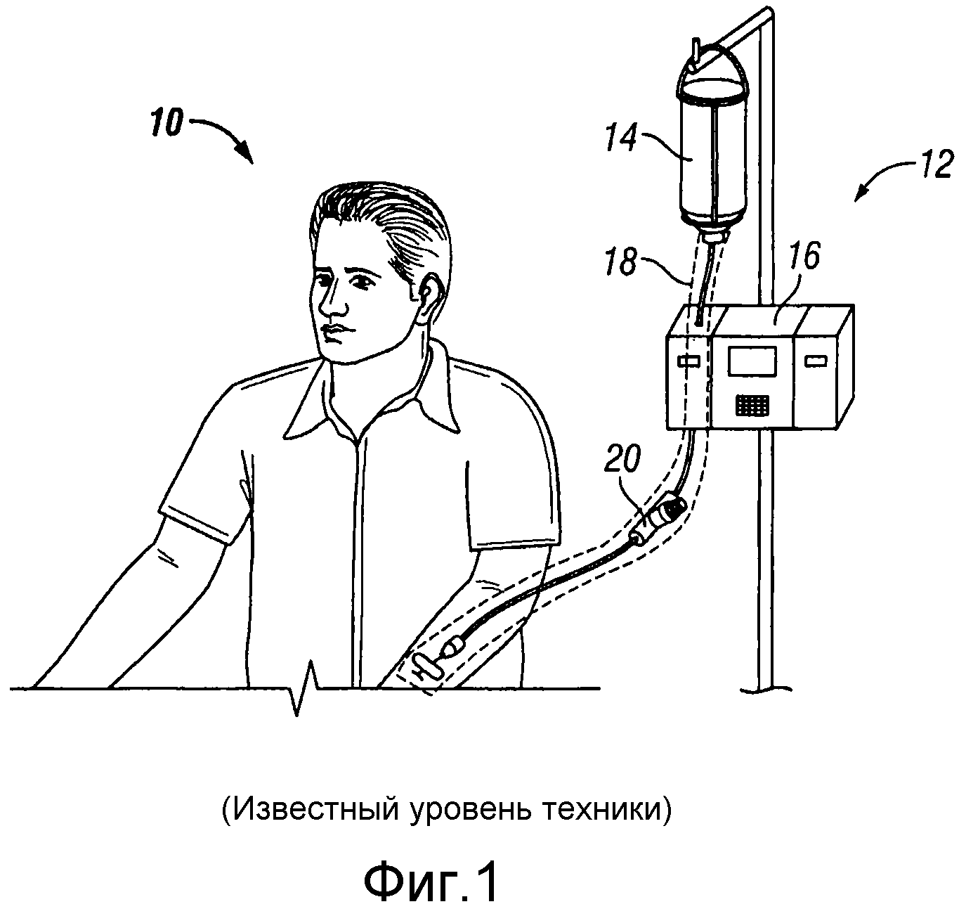 Безыгольный отыграть предыюньский