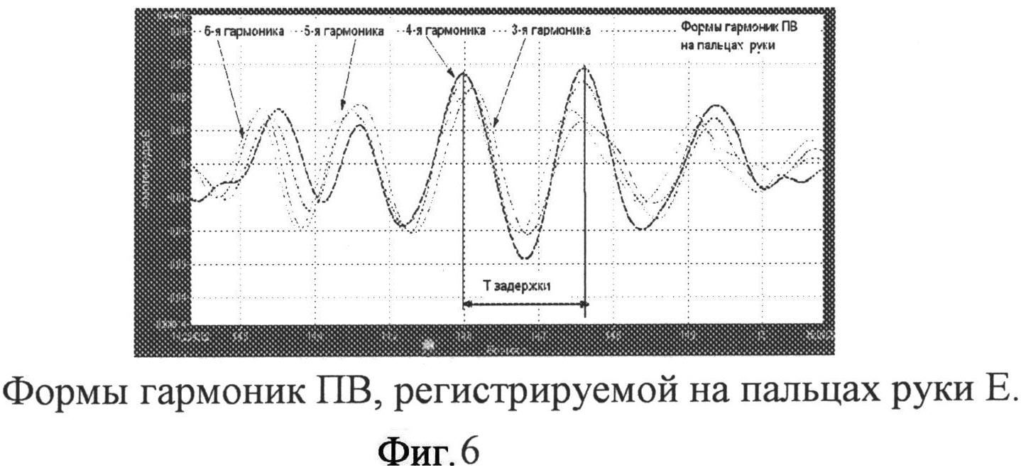 Курсовая работа по теме Устройство для измерения скорости распространения пульсовой волны кровотока