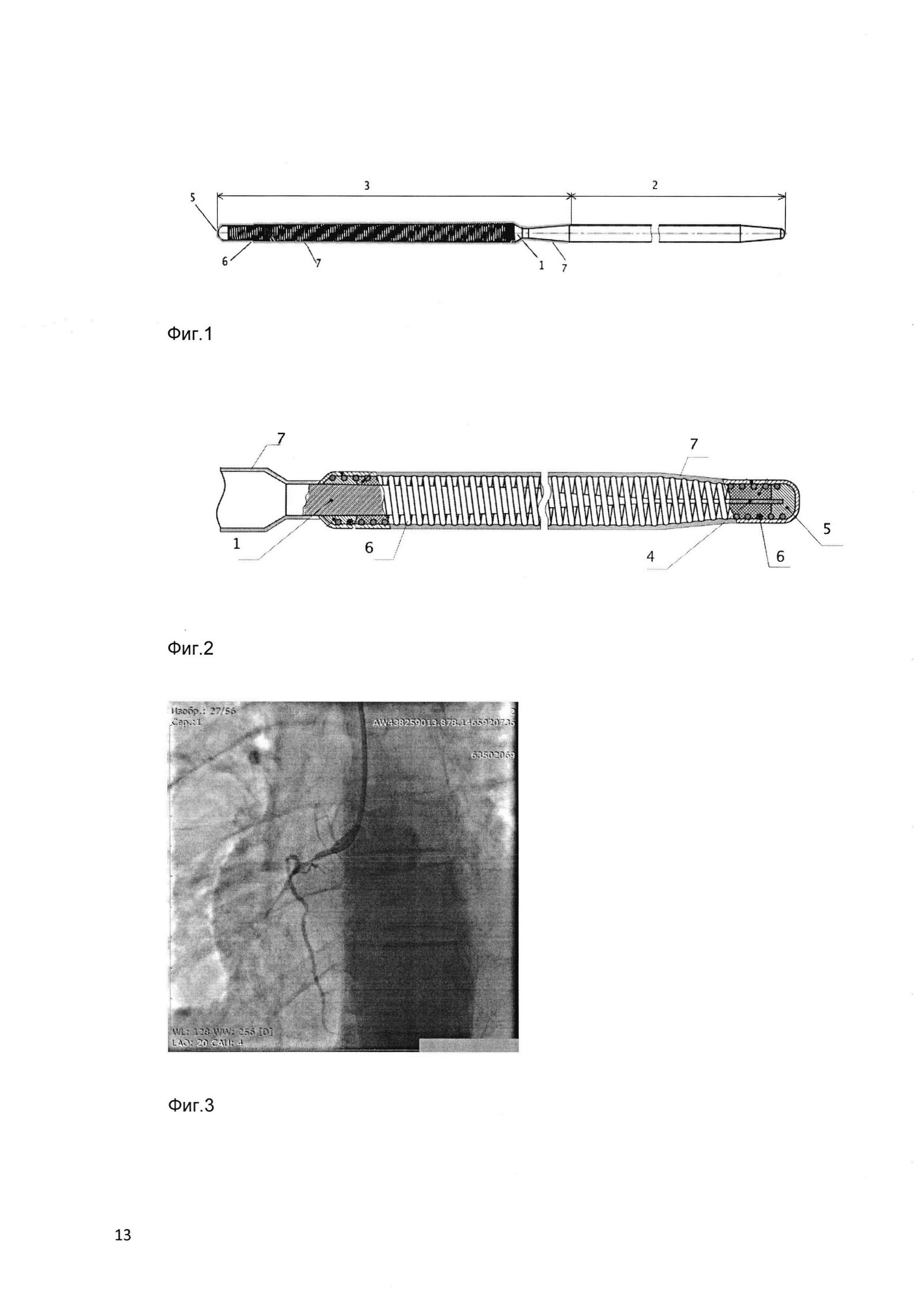 Коронарный проводник и способ стентирования сложных поражений коронарных артерий с его использованием
