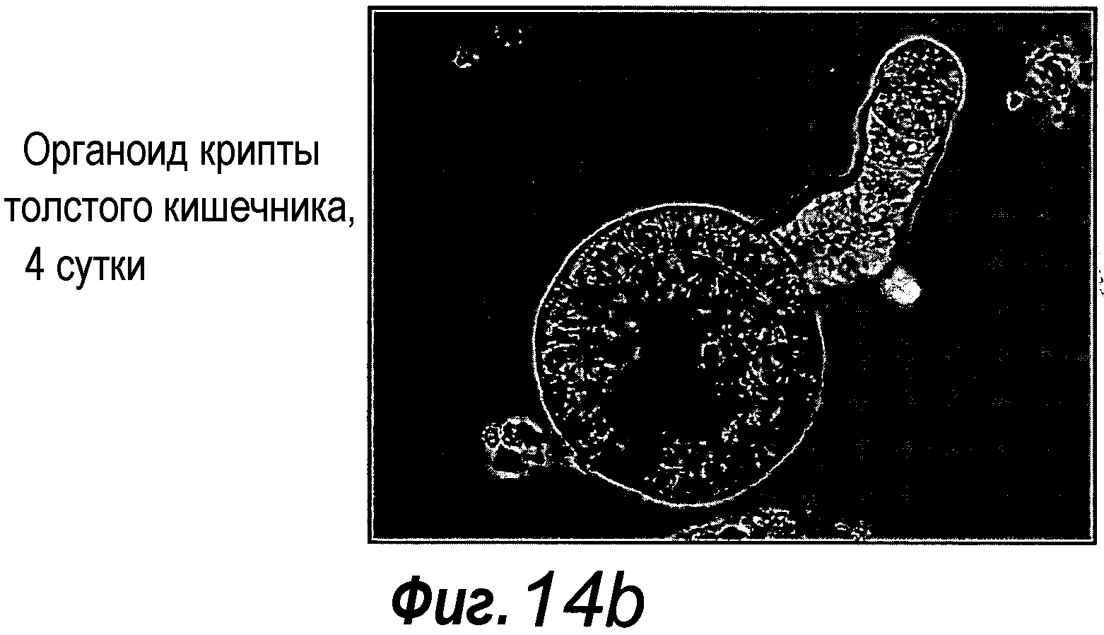 КУЛЬТУРАЛЬНАЯ СРЕДА ДЛЯ ЭПИТЕЛИАЛЬНЫХ СТВОЛОВЫХ КЛЕТОК И ОРГАНОИДОВ, СОДЕРЖАЩИХ УКАЗАННЫЕ СТВОЛОВЫЕ КЛЕТКИ