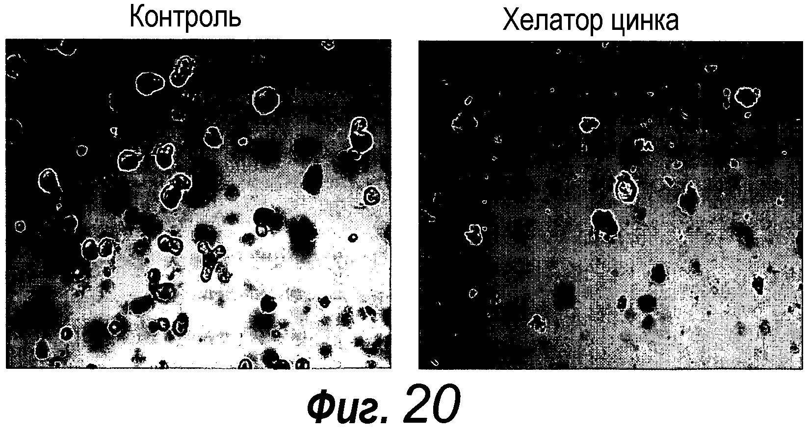 КУЛЬТУРАЛЬНАЯ СРЕДА ДЛЯ ЭПИТЕЛИАЛЬНЫХ СТВОЛОВЫХ КЛЕТОК И ОРГАНОИДОВ, СОДЕРЖАЩИХ УКАЗАННЫЕ СТВОЛОВЫЕ КЛЕТКИ