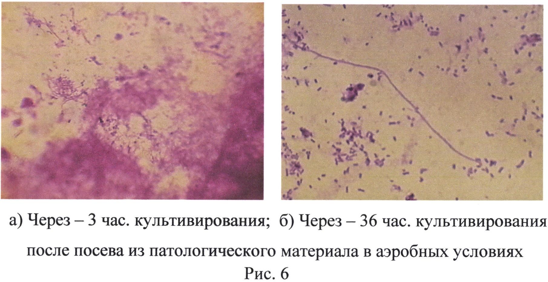 Некробактериоз микроскопия