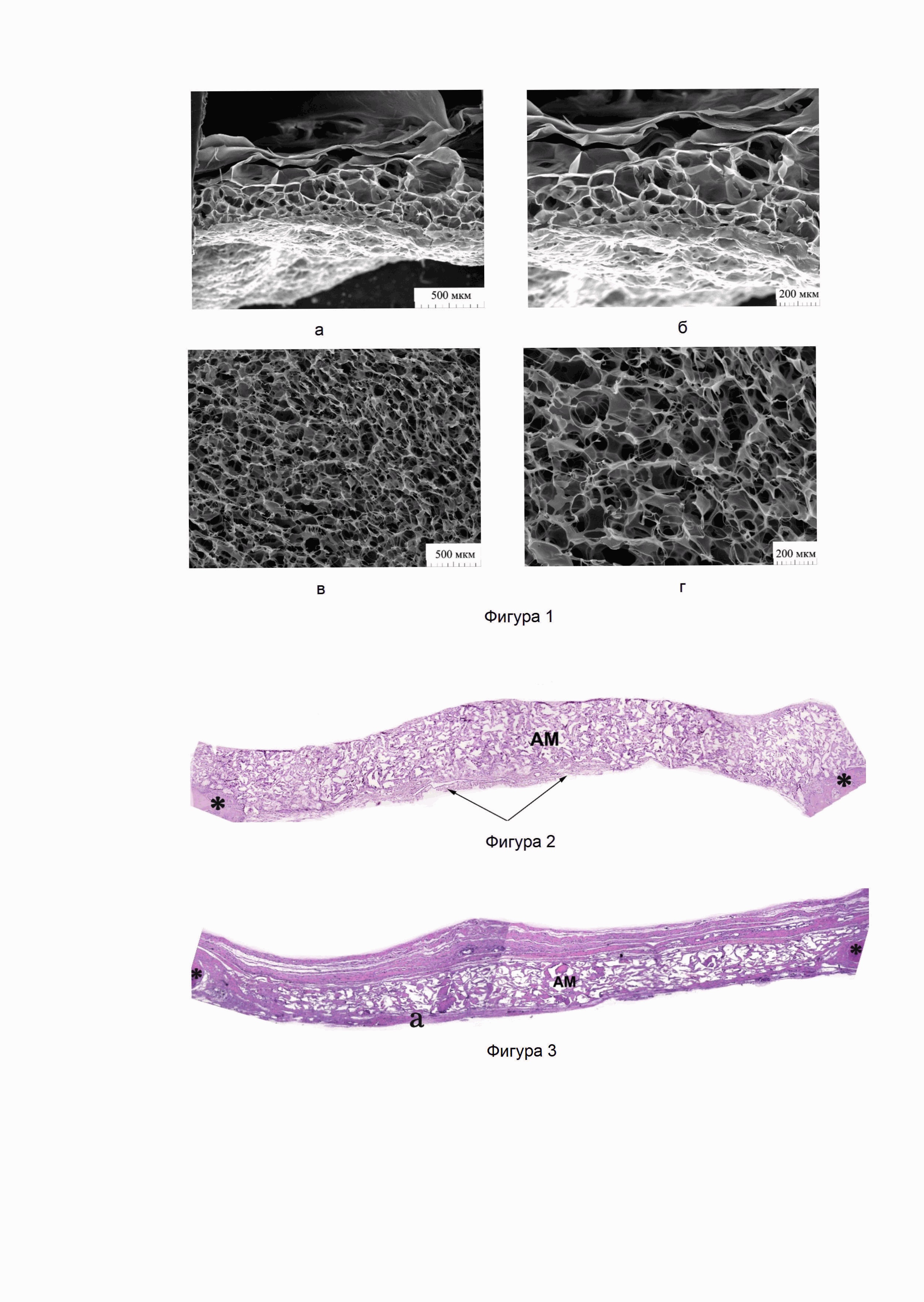 Биорезорбируемая барьерная мембрана на основе полисахарида для направленной регенерации костной ткани