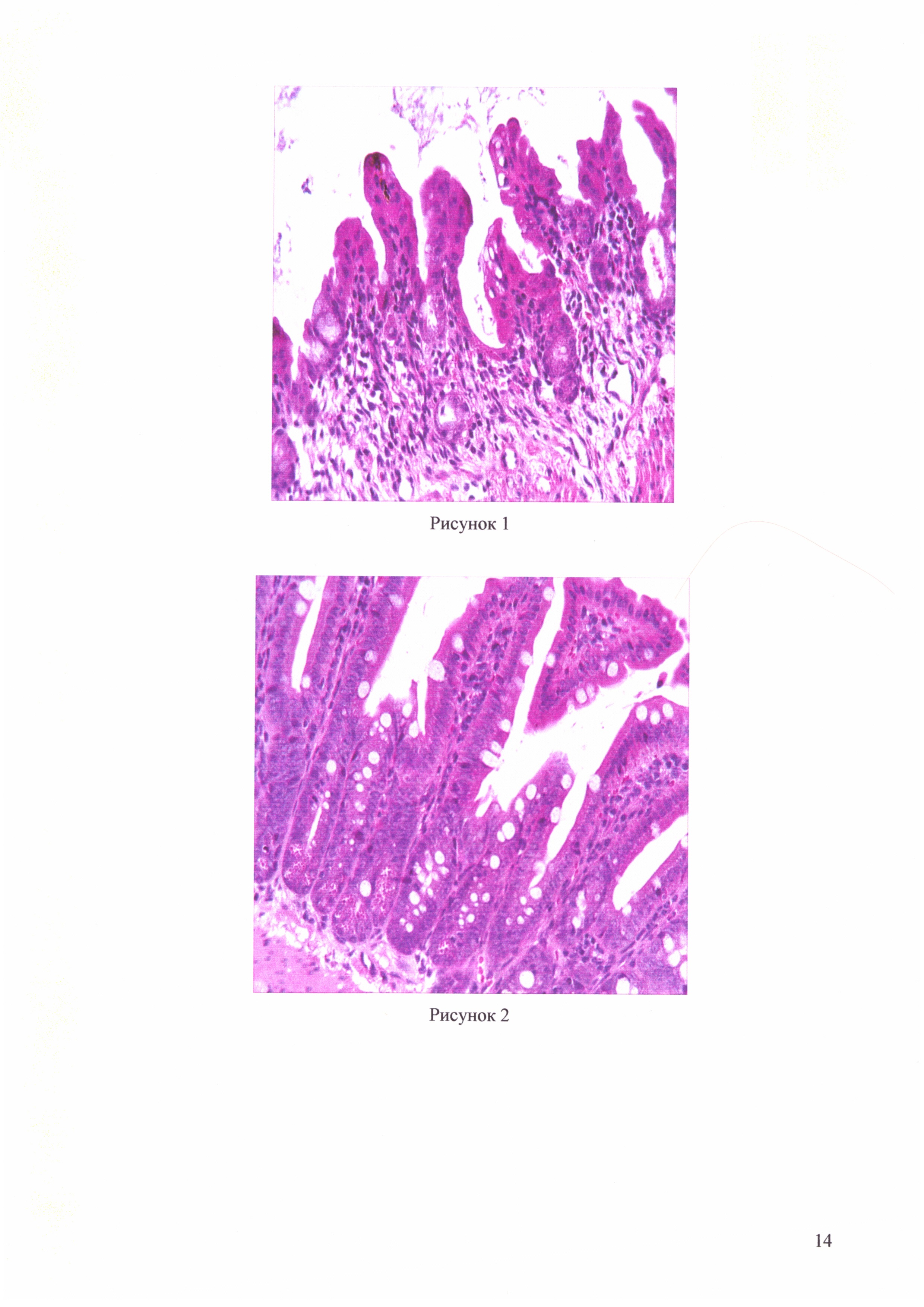 Фармацевтическая композиция для терапии воспалительных заболеваний слизистых оболочек кишечника на основе штамма Lactobacillus brevis 47f, проявляющая местную противовоспалительную активность