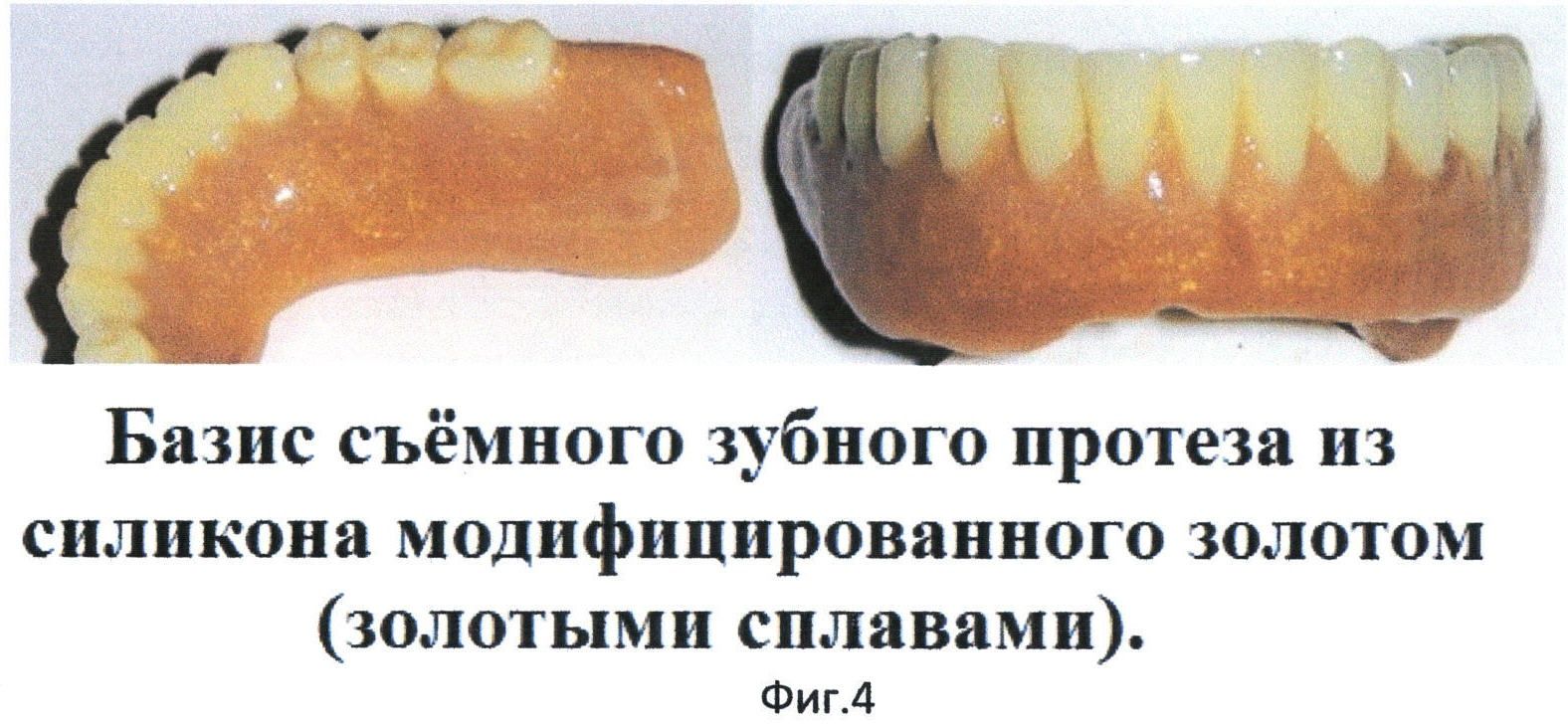 Акриловые пластмассы в стоматологии презентация