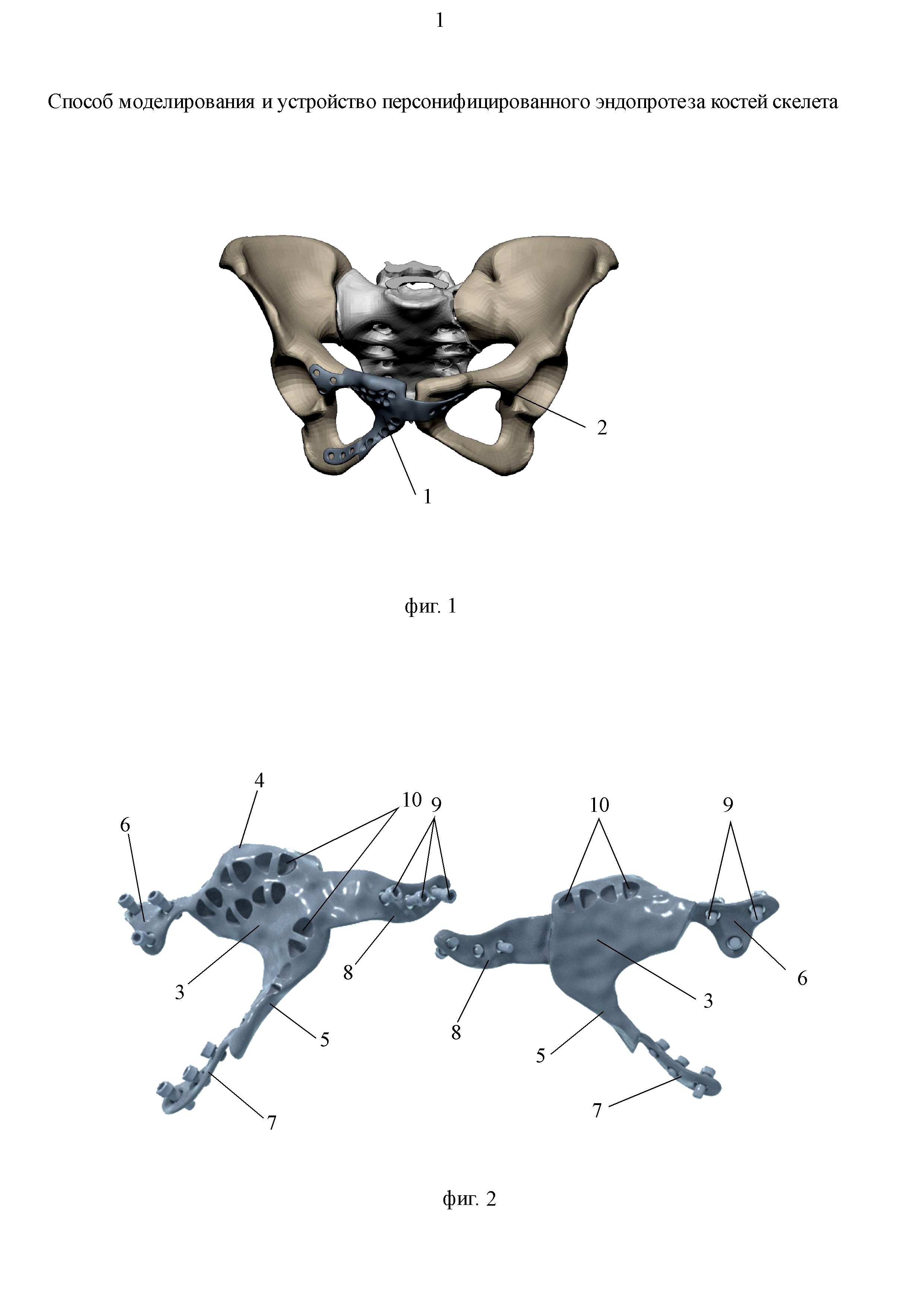 Способ моделирования и устройство персонифицированного эндопротеза костей скелета
