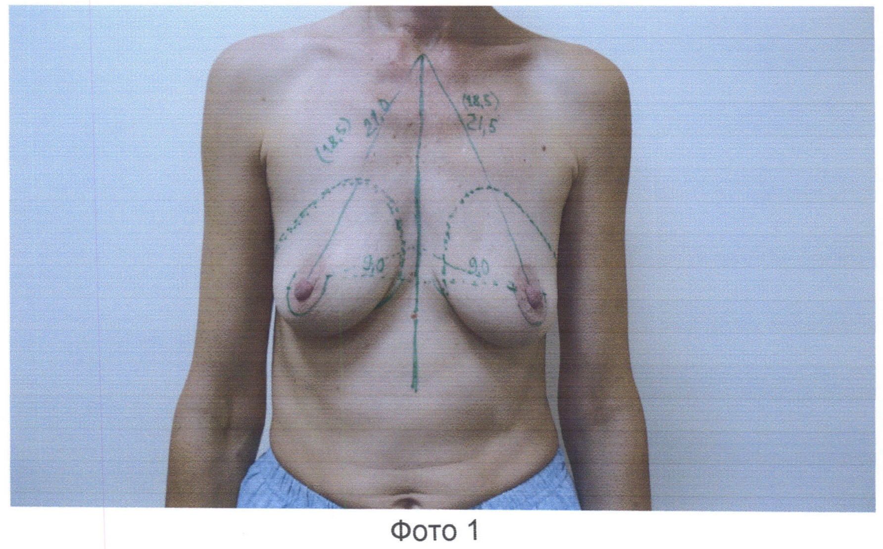 форма груди у русских женщин фото 54