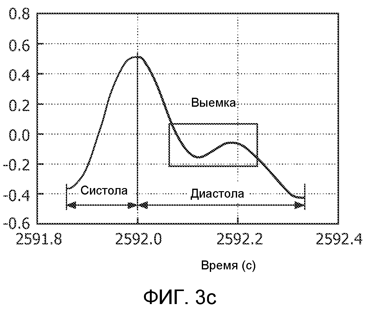 СПОСОБ И УСТРОЙСТВО ДЛЯ ОБРАБОТКИ ФОТОПЛЕТИЗМОГРАФИЧЕСКИХ СИГНАЛОВ