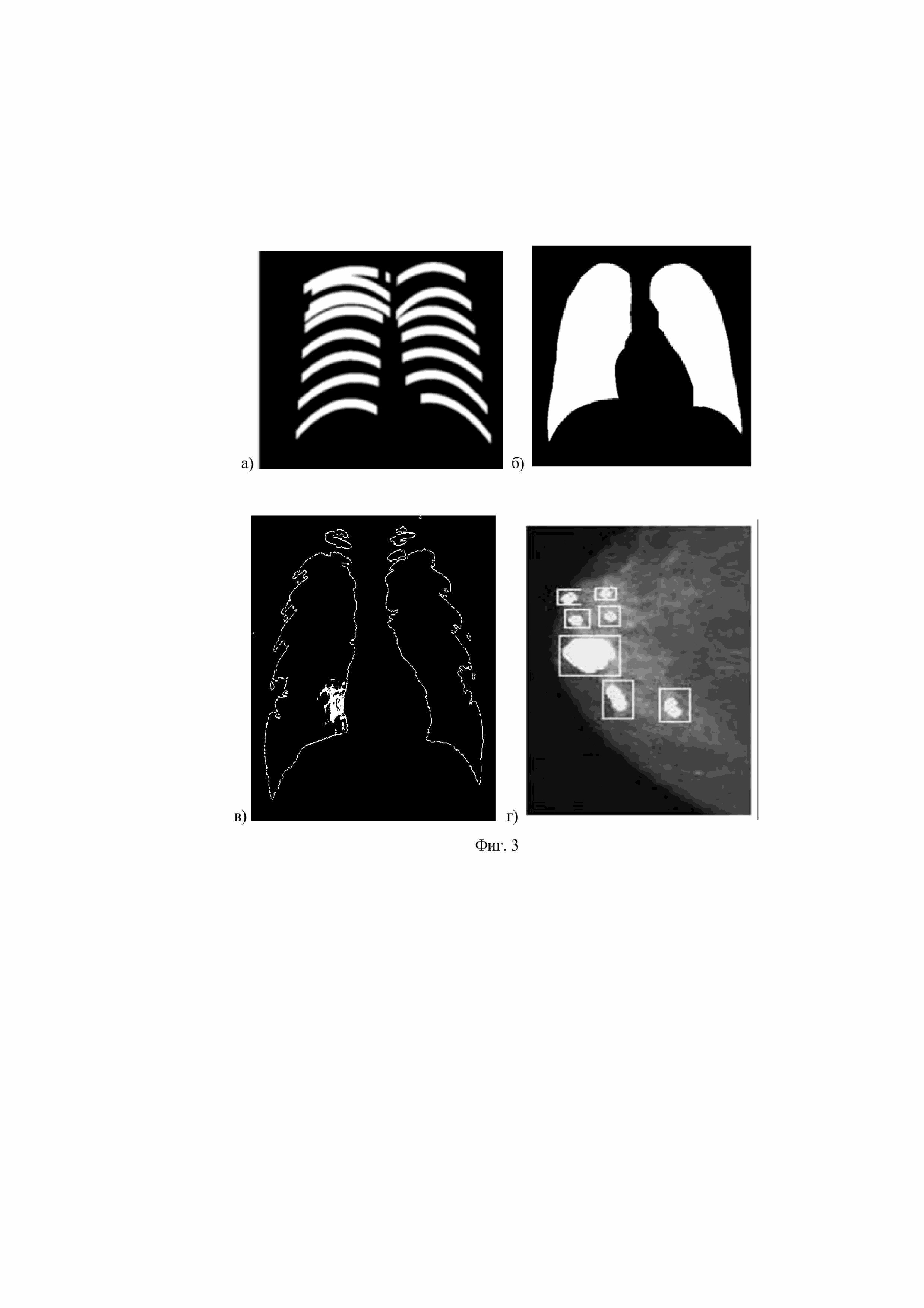 Способ автоматической классификации рентгеновских изображений с использованием масок прозрачности