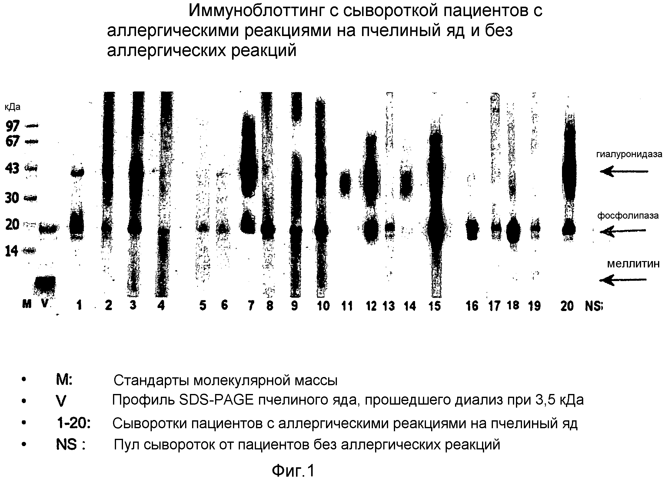 Иммуноблоттинг. Иммуноблоттинг аллергия. Метод иммуноблоттинг на аллергены. Иммуноблоттинг аллергопанель. Иммуноблоттинг микробиология.