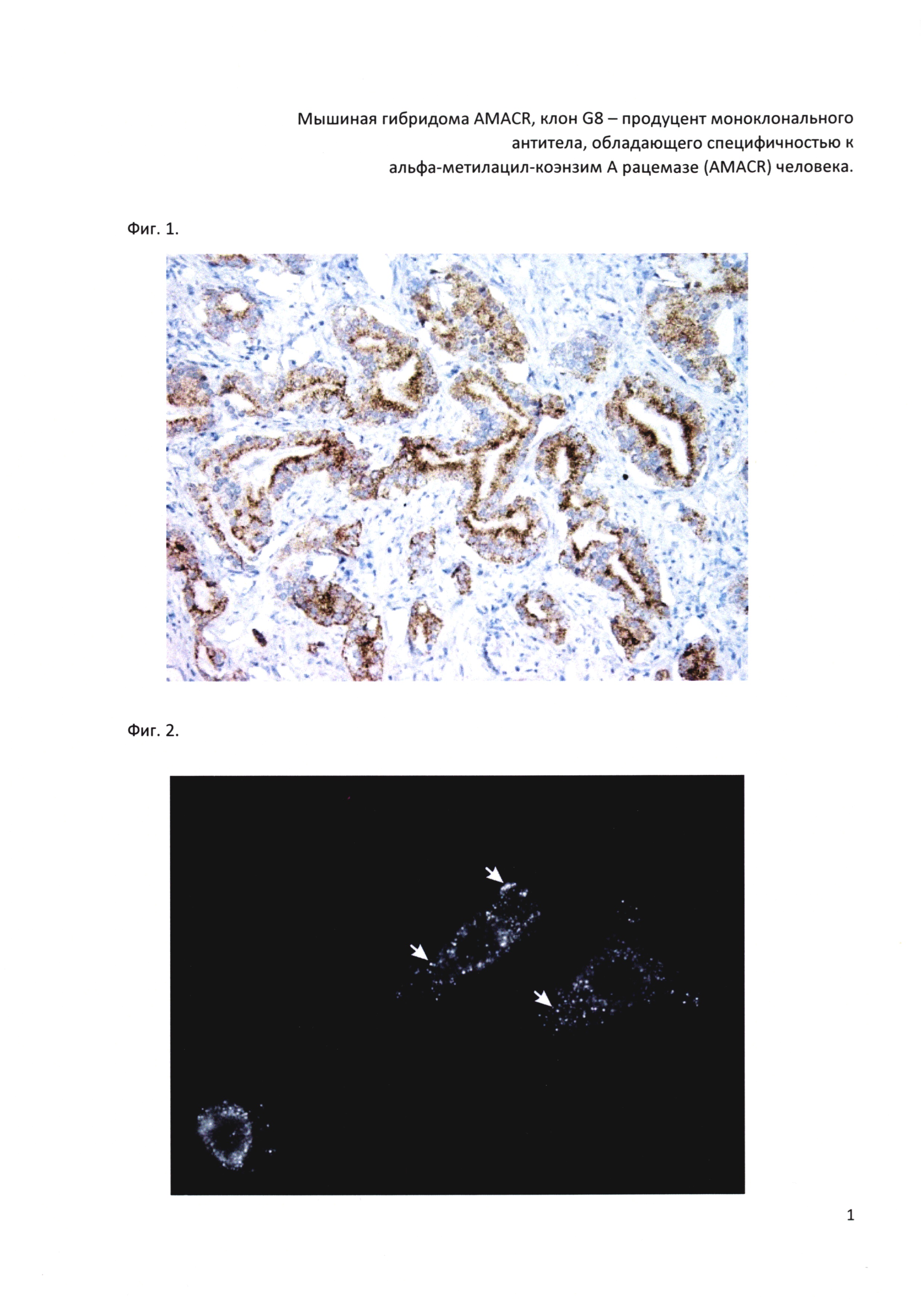 Мышиная гибридома AMACR, клон G8 - продуцент моноклонального антитела, обладающего специфичностью к альфа-метилацил-коэнзим A рацемазе (AMACR) человека