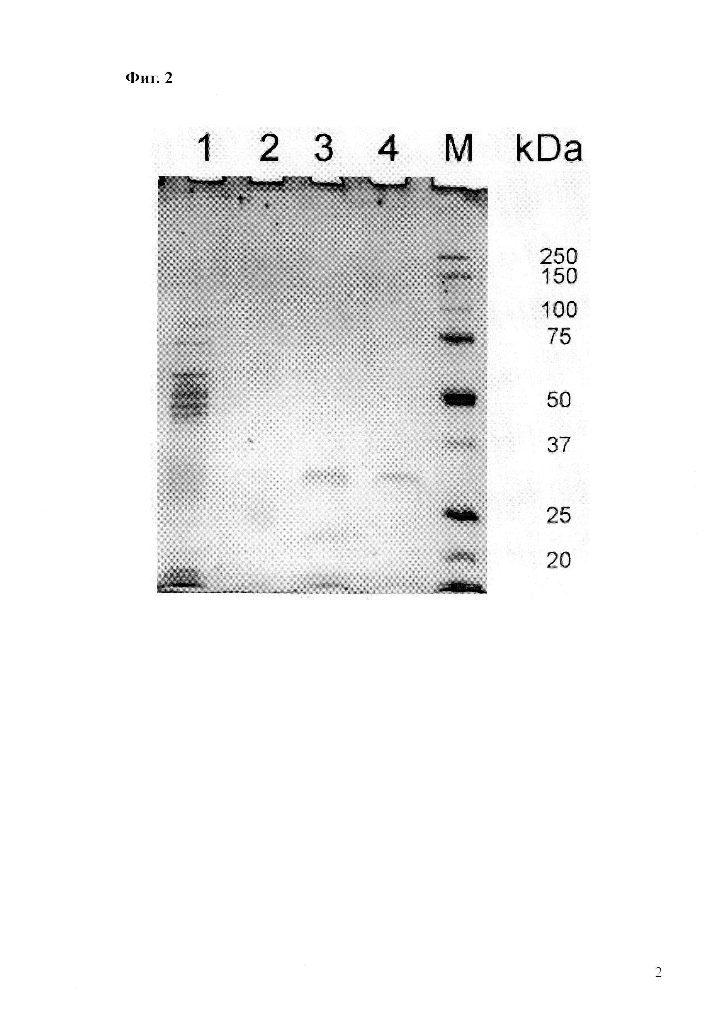Рекомбинантный продуцент омега-амидазы человека Nit2 на основе Escherichia coli