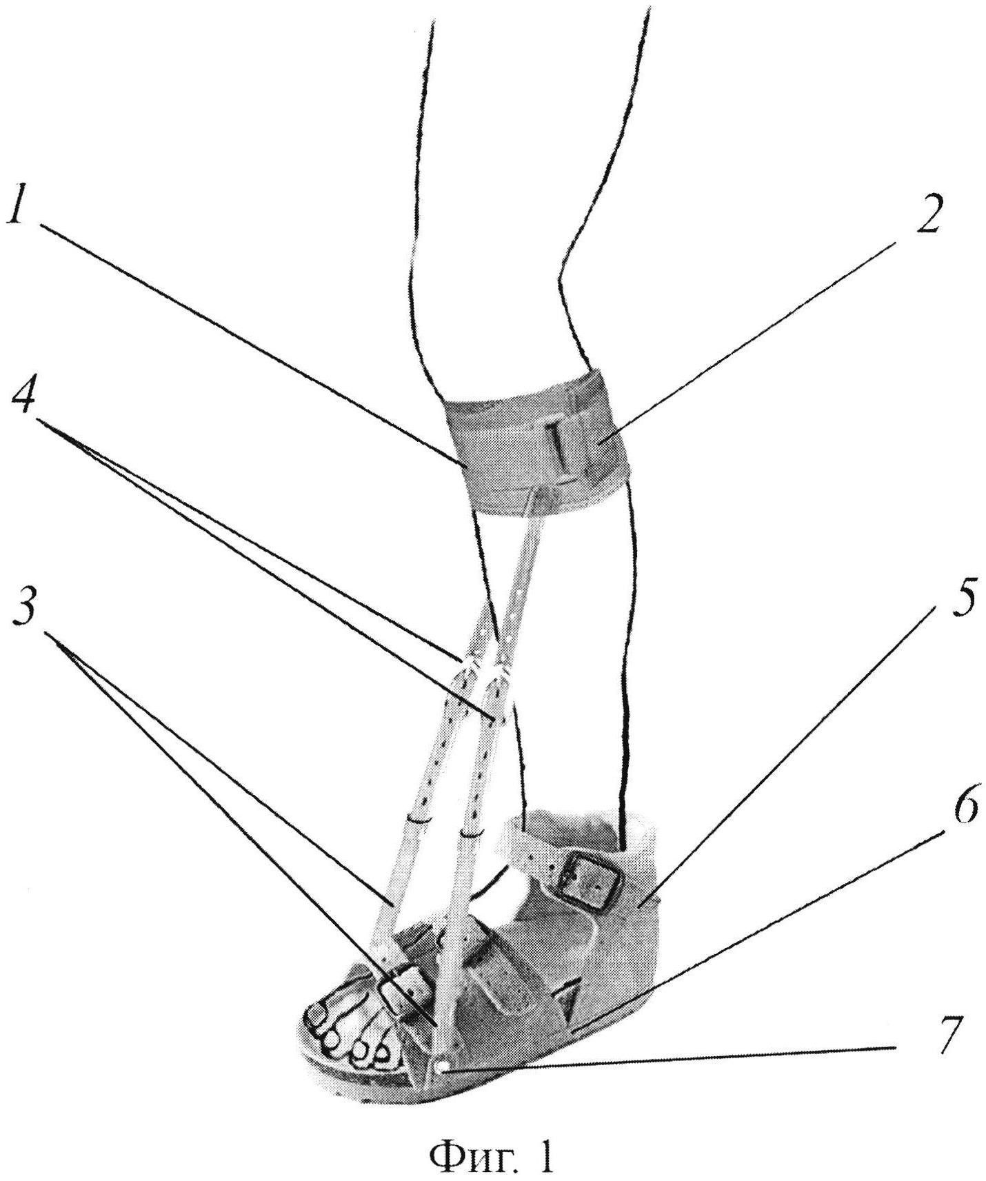 Укладка голеностопного сустава. Анкерная фиксация ахиллова сухожилия. Тренажер для растяжки ахиллова сухожилия ног. Анкерный винт для фиксирования ахиллова сухожилия. Голеностоп ахиллова сухожилия.