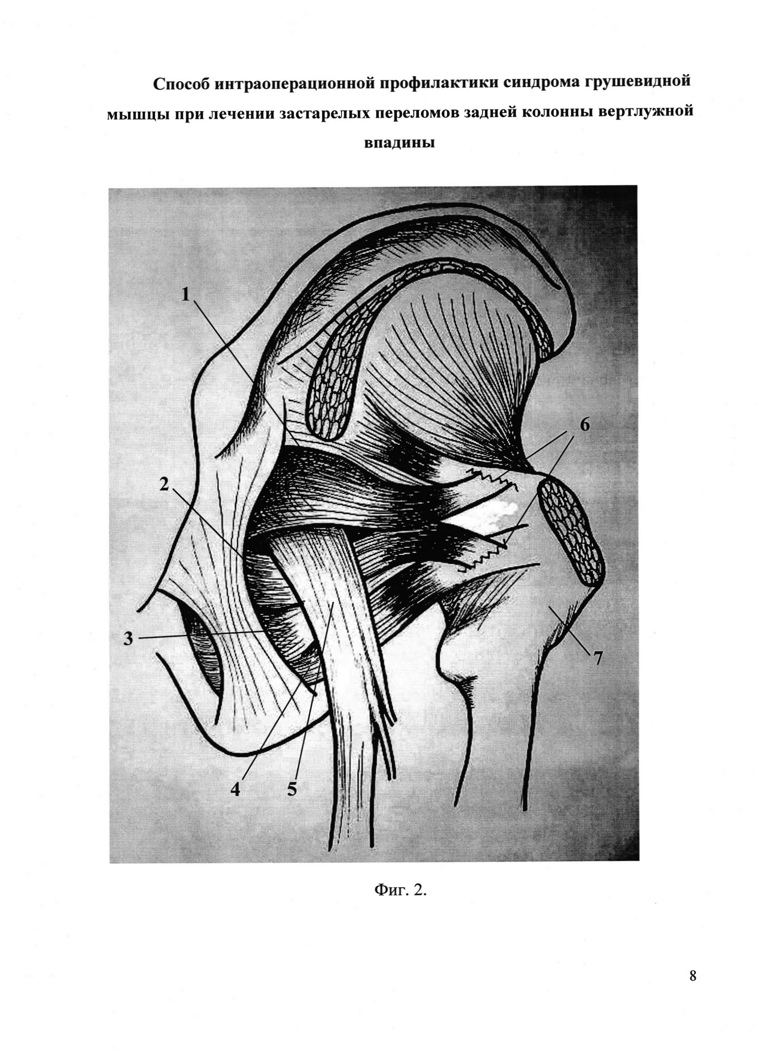 Тазобедренный сустав анатомия грушевидная мышца