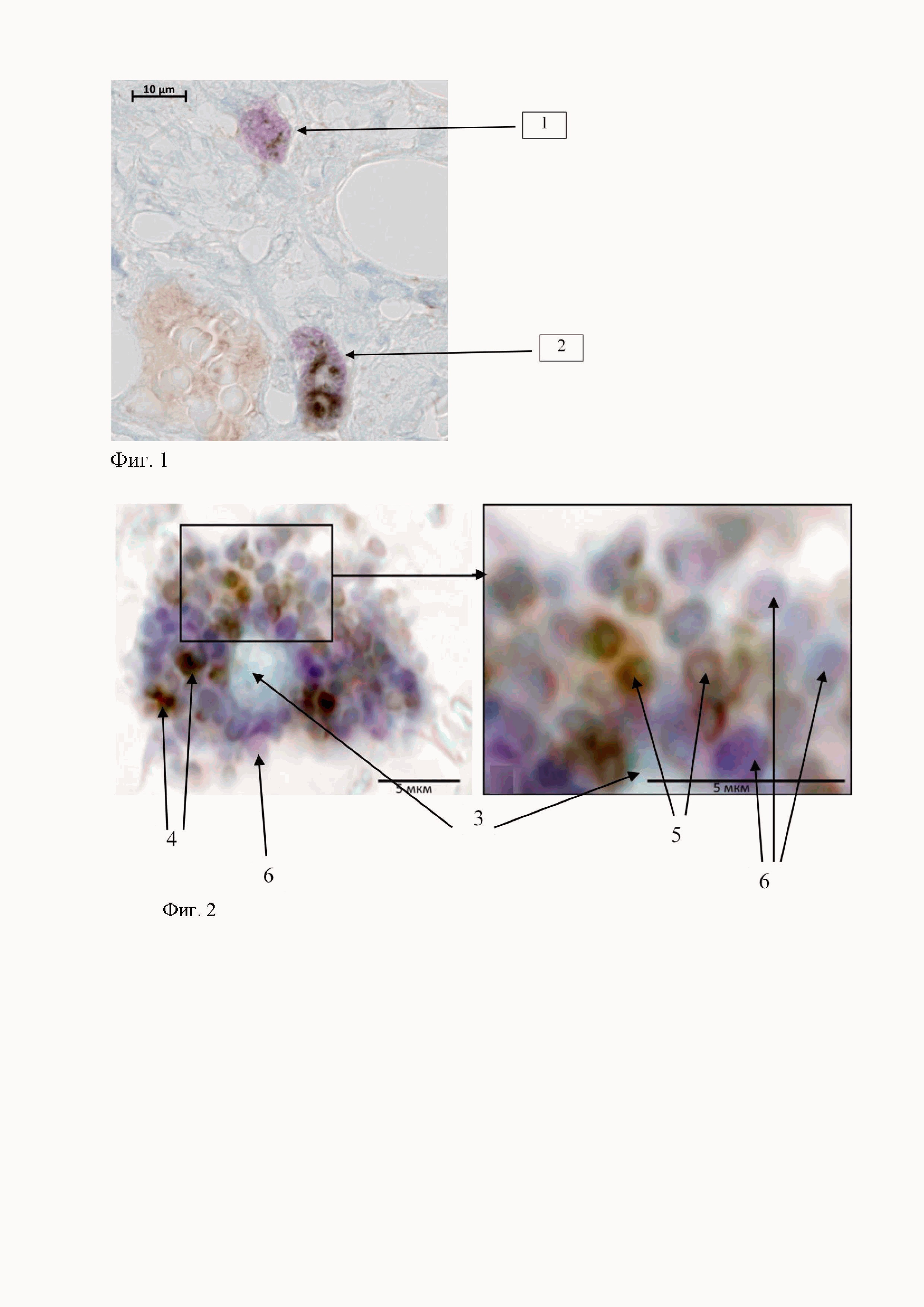 Способ метахроматической идентификации с визуализацией триптаза-позитивных тучных клеток