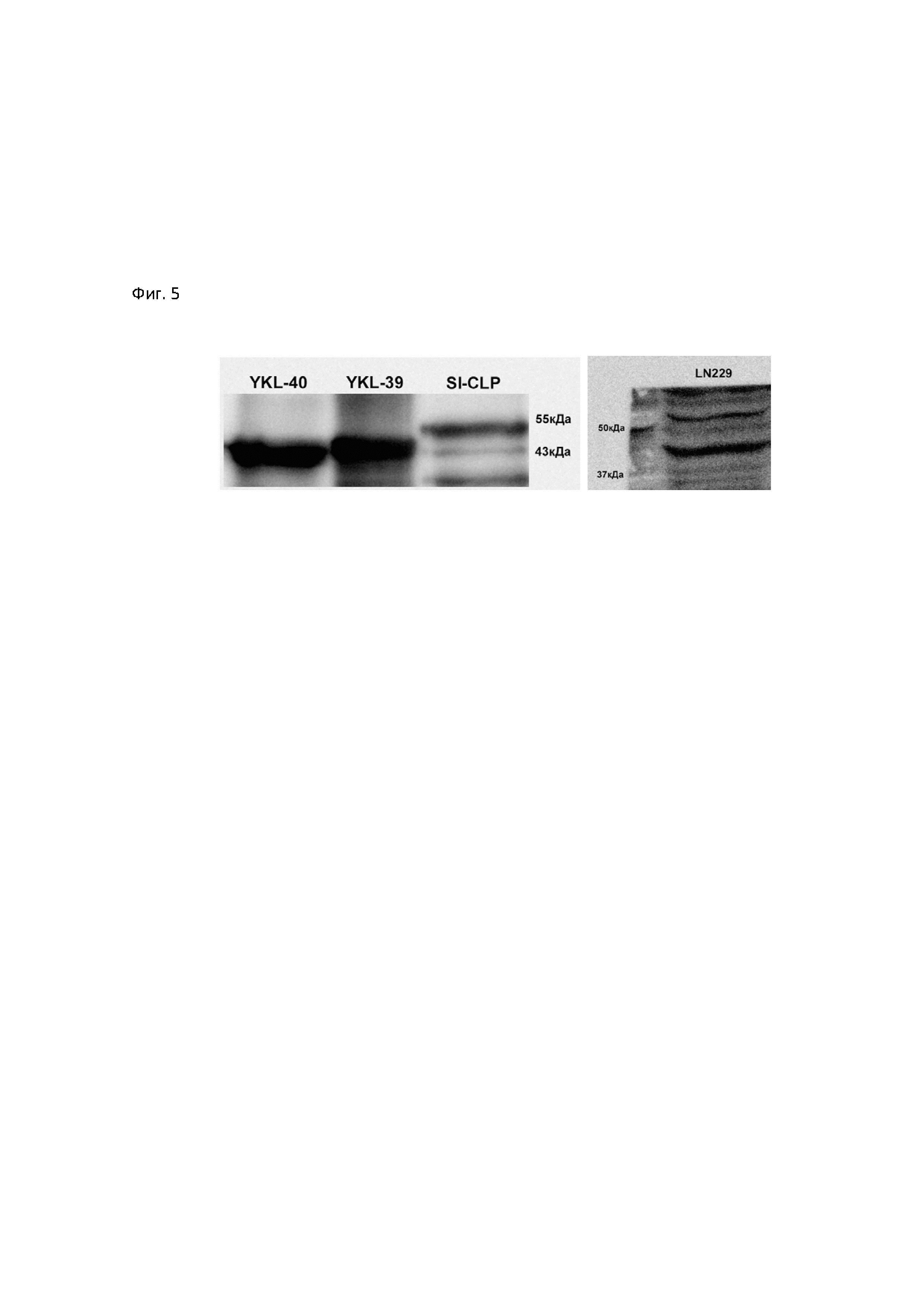 Мышиная гибридома YKL-40, клон 2G8 C10 - продуцент моноклонального антитела, обладающего специфичностью к цитоплазмотическим антигенам YKL-39, YKL-40 и SI-CLP человека