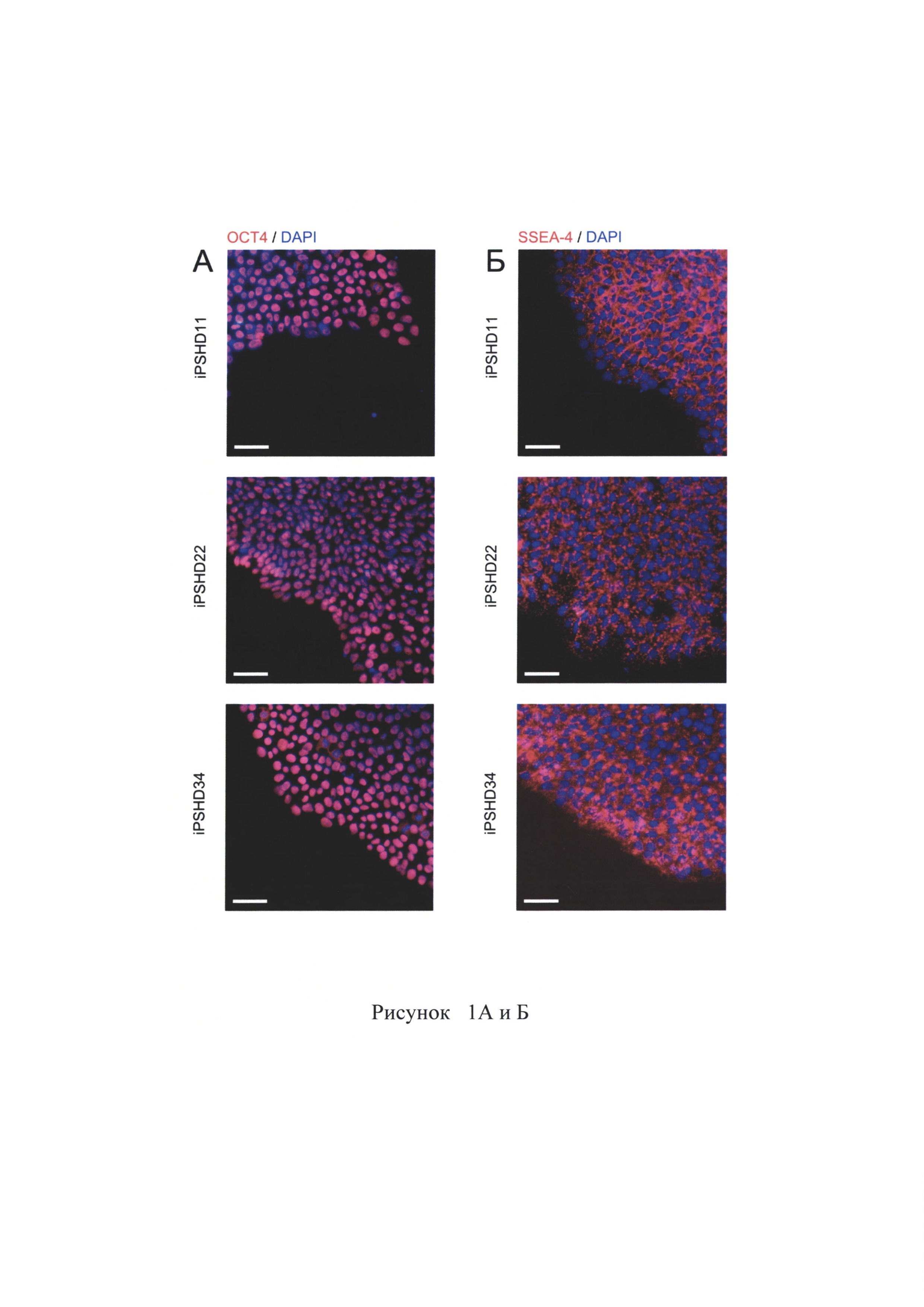 Ноотропная композиция на основе полипептидных комплексов, выделенных из нейронов и глиальных клеток, полученных методом направленной дифференцировки индуцированных плюрипотентных стволовых клеток человека