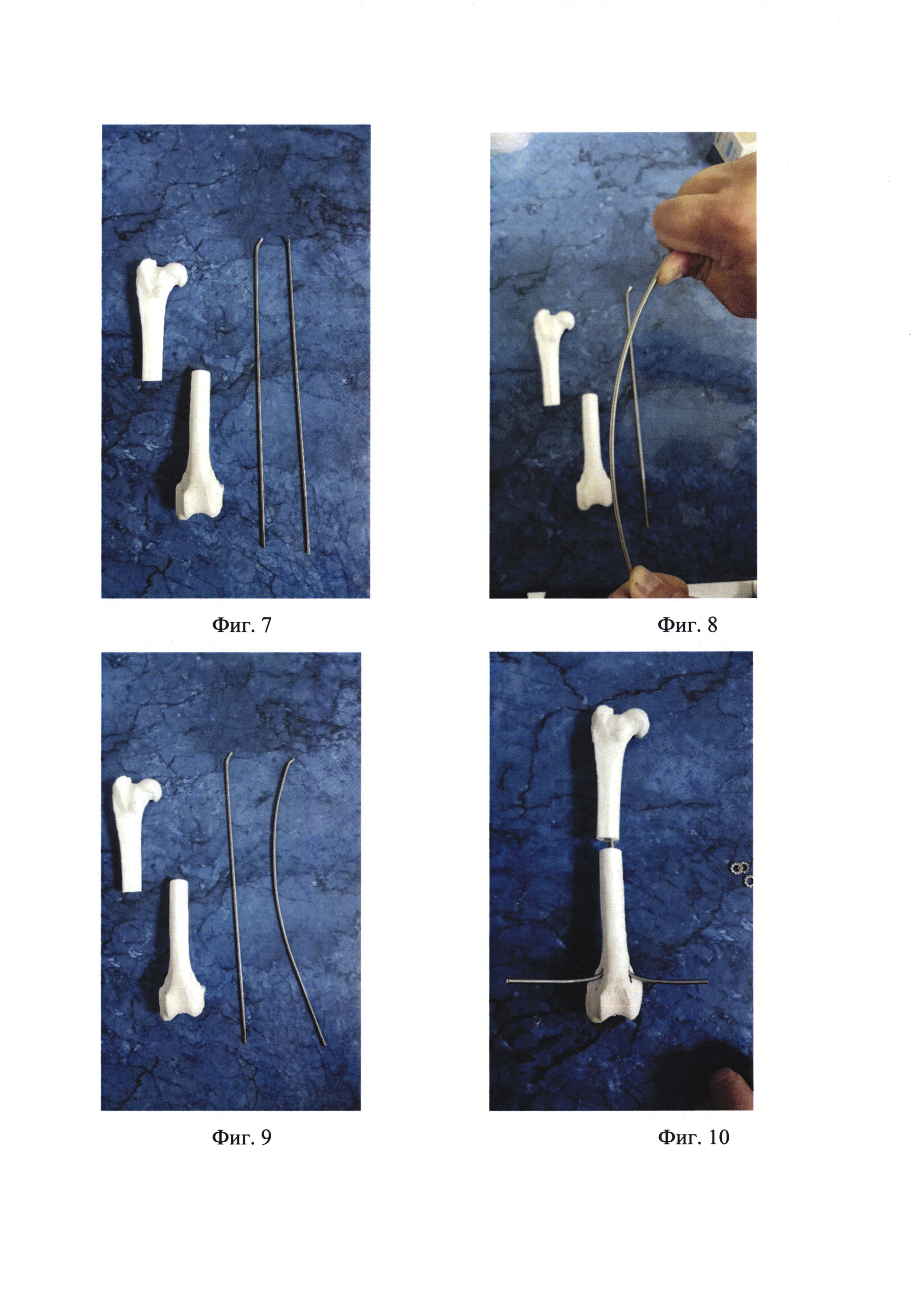 Интрамедуллярный стержень для остеосинтеза трубчатых костей
