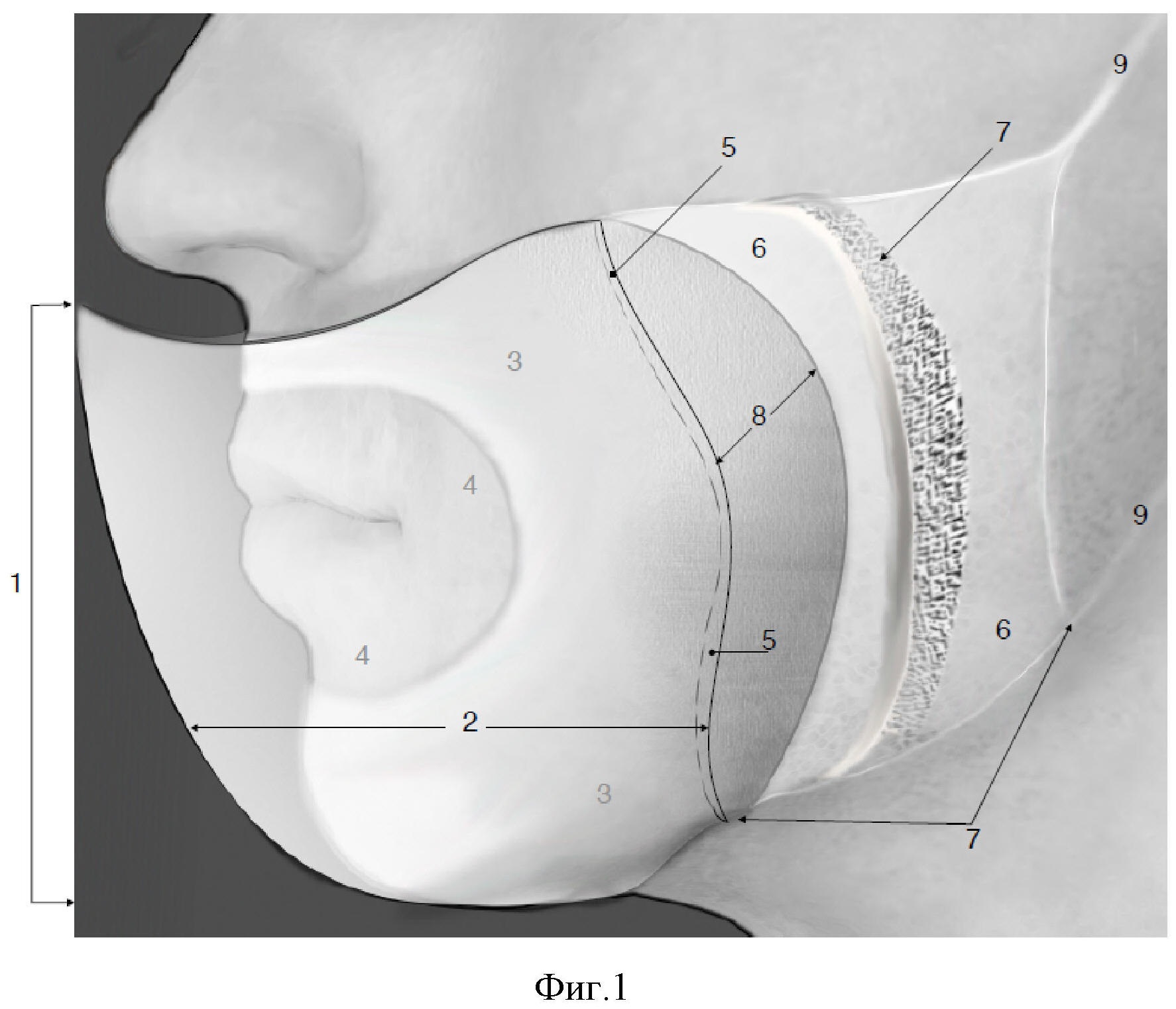 Медицинская маска каркасная барьерно-отводящего типа (варианты)