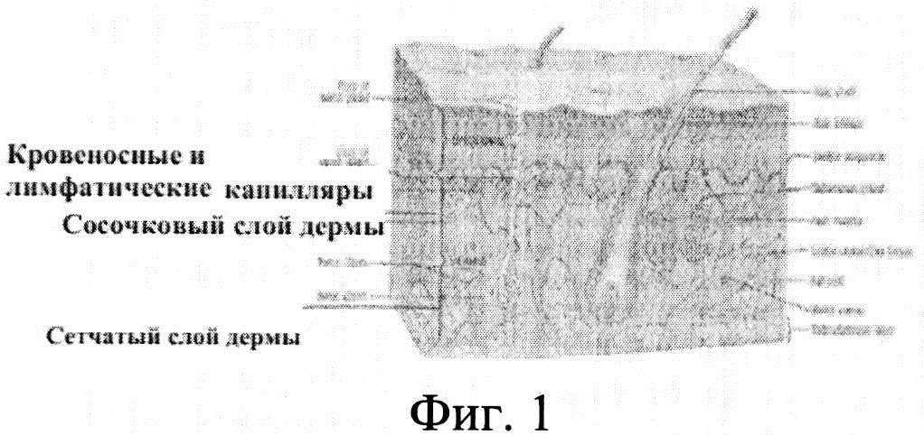 СПОСОБЫ ДОСТАВКИ АКТИВНЫХ СРЕДСТВ В ЛИМФАТИЧЕСКУЮ СИСТЕМУ