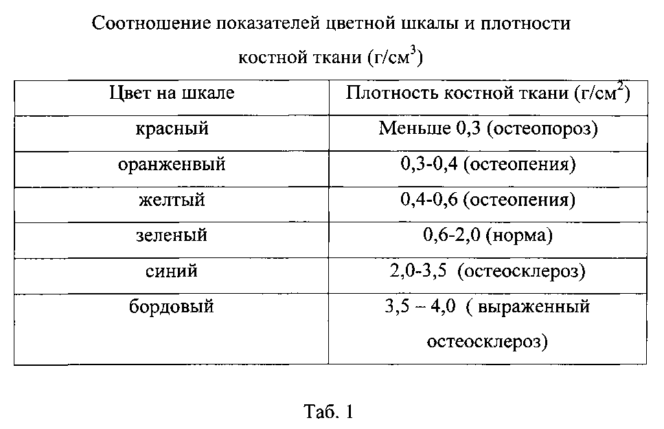 Денситометрия показатели. Денситометрия костей показатели норма. Денситометрия z критерий норма. Минеральная плотность костной ткани норма. Остеопороз показатели денситометрии нормы.