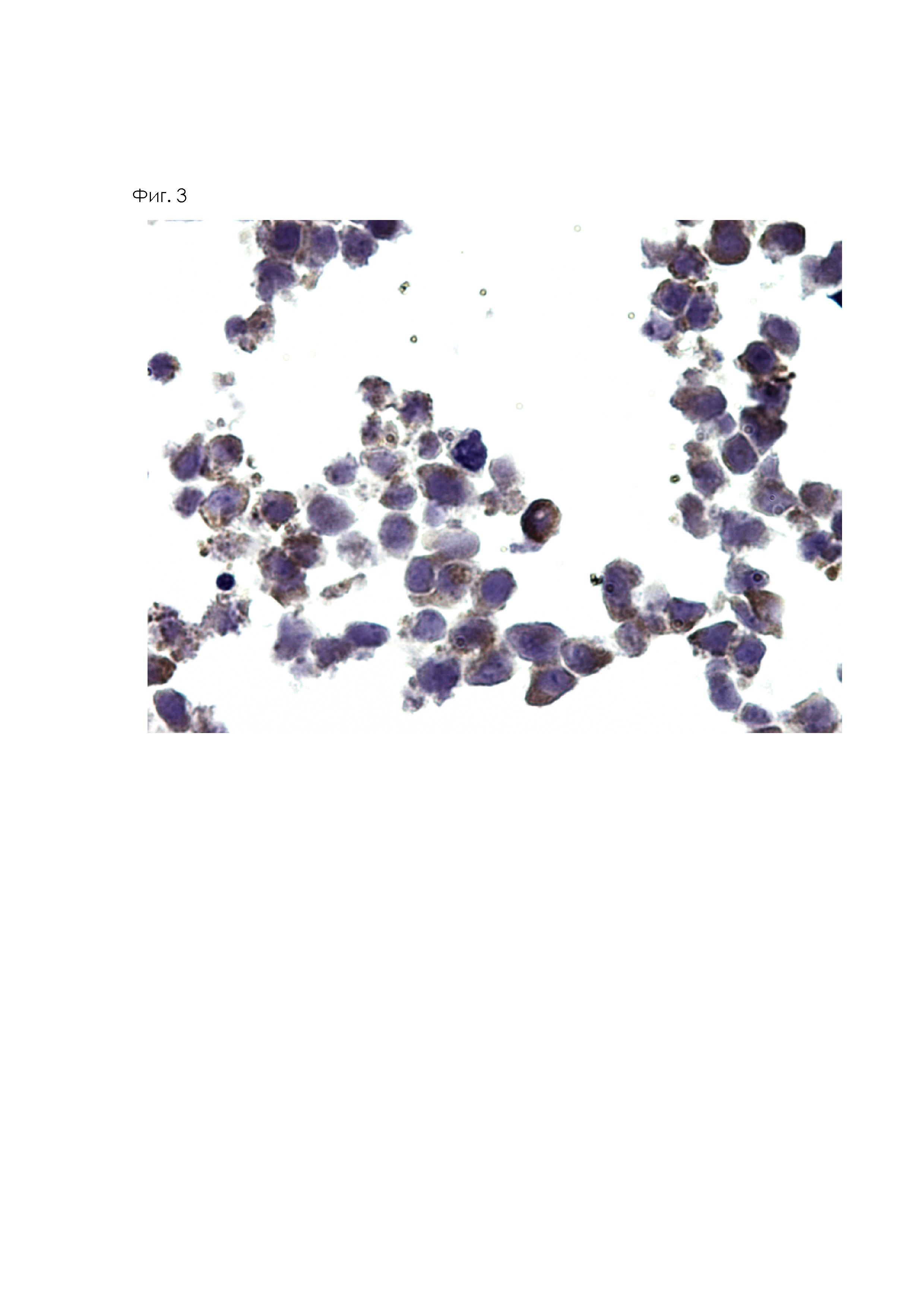 Мышиная гибридома SI-CLP, клон 3D4 - продуцент моноклонального антитела, обладающего специфичностью к белку SI-CLP