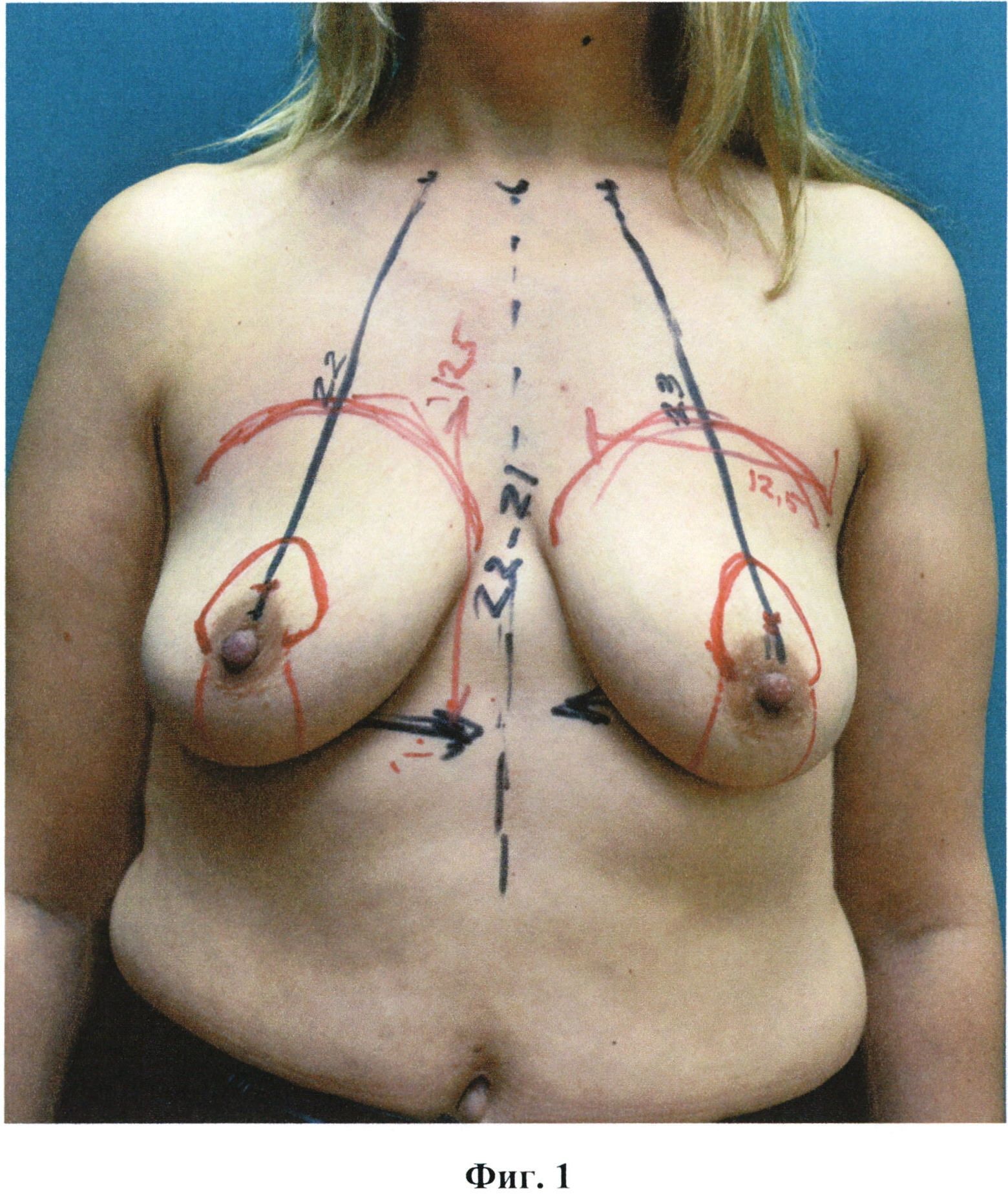 необычная форма груди у женщин фото 107