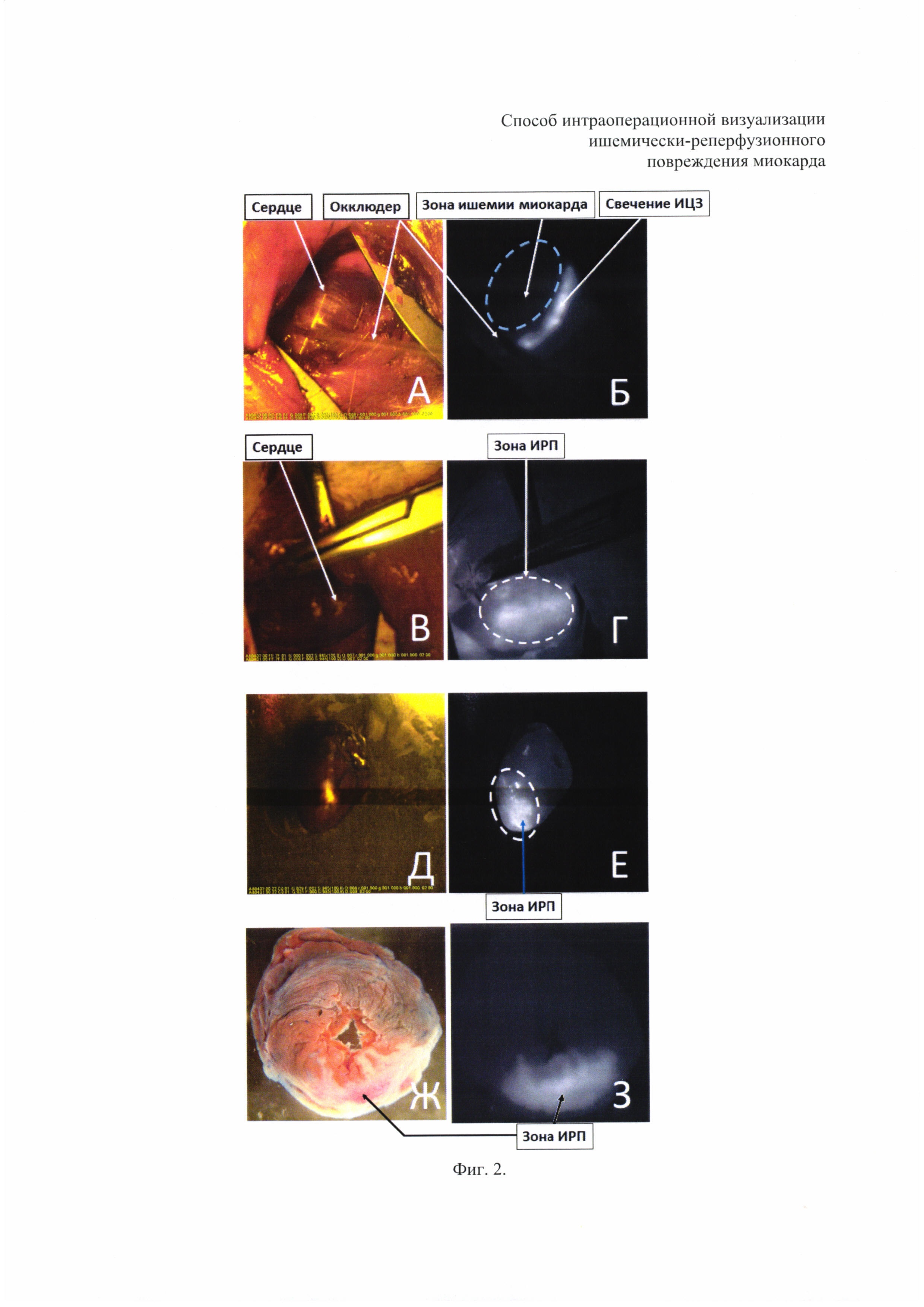 Способ интраоперационной визуализации ишемически-реперфузионного повреждения миокарда